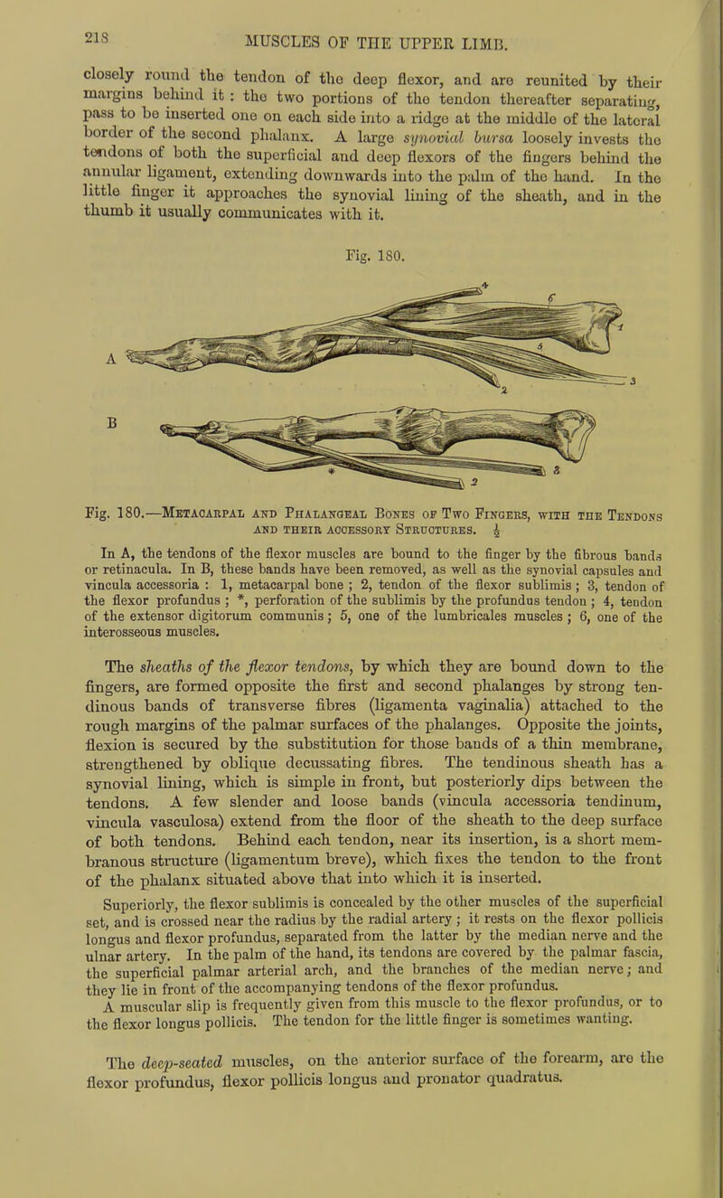 closely roiuicl the tendon of the deep flexor, and are reunited by their margins behind it : the two portions of the tendon thereafter separating, pass to be inserted one on each side into a ridge at the middle of the lateral border of the second phalanx. A large synovial bursa loosely invests the tendons of both the superficial and deep flexors of the fiugors behind the annular ligament, oxtendmg downwards into the palm of the hand. In the little finger it approaches the synovial lining of the sheath, and in the thumb it usually communicates with it. Fig. 180.—Metacarpal and Phalangeal Bones op Two Fingers, with tee Tendons AND THEIR ACCESSORY STRUCTURES. ^ In A, the tendons of the flexor muscles are bound to the finger by the fibrous bands or retinacula. In B, these bands have been removed, as well as the synovial capsules and vincula accessoria : 1, metacarpal bone ; 2, tendon of the flexor sublimis; 3, tendon of the flexor profundus ; *, perforation of the sublimis by the profundus tendon ; 4, tendon of the extensor digitorum communis j 5, one of the lumbricales muscles; 6, one of the interosseous muscles. The sheaths of the flexor tendons, by which they are bound down to the fingers, are formed opposite the first and second phalanges by strong ten- dinous bands of transverse fibres (ligamenta vaginalia) attached to the rough margins of the palmar surfaces of the phalanges. Opposite the joints, flexion is secured by the substitution for those bands of a thin membrane, strengthened by oblique decussating fibres. The tendinous sheath has a synovial lining, which is simple in front, but posteriorly dips between the tendons. A few slender and loose bands (vincula accessoria tendinum, vincula vasculosa) extend from the floor of the sheath to the deep surface of both tendons. Behind each tendon, near its insertion, is a short mem- branous structure (ligamentum breve), which fixes the tendon to the front of the phalanx situated above that into which it is inserted. Superiorly, the flexor sublimis is concealed by the other muscles of the superficial set, and is crossed near the radius by the radial artery ; it rests on the flexor pollicis longus and flexor profundus, separated from the latter by the median nerve and the ulnar artery. In the palm of the hand, its tendons are covered by the palmar fascia, the superficial palmar arterial arch, and the branches of the median nerve; and they lie in front of the accompanying tendons of the flexor profundus. A muscular slip is frequently given from this muscle to the flexor profundus, or to the flexor longus pollicis. The tendon for the little finger is sometimes wanting. The deep-seated muscles, on the anterior surface of the forearm, are the flexor profundus, flexor pollicis longus and pronator quadratus.