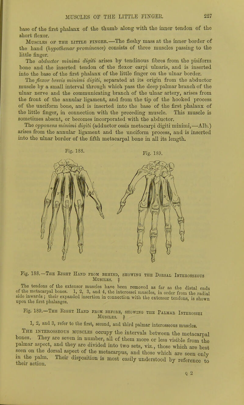 base of the first phalanx of the thumb along with the inner tendon of the short flexor. Muscles op the little finger.—The fleshy mass at the inner border of the hand {hypothenar prominence) consists of three muscles passing to the little finger. The abductor minimi digiti arises by tendinous fibres from the pisiform bone and the inserted tendon of the flexor carpi uluaris, and is inserted into the base of the fii'st phalanx of the little finger on the ulnar border. The flexor brevis minimi dif/iti, separated at its origin from the abductor muscle by a small interval through which pass the deep palmar branch of the ulnar nerve and the communicating branch of the ulnar artery, arises from the front of the annular ligament, and from the tip of the hooked process of the unciform bone, and is inserted into the base of the first phalanx of the little finger, in connection with the preceding muscle. This muscle is sometimes absent, or becomes incorporated with the abductor. The opponens minimi dicjiti (adductor ossis metacarpi digiti minimi,—Alb.) arises from the annular ligament and the unciform process, and is inserted into the ulnar border of the fifth metacarpal bone in all its length. Fig. 188, Fig. 189. Fig. 188.—The Right Hand from behind, showing the Doksal Interosseous Muscles. | The tendons of the extensor muscles have been removed as far as the distal ends oi the metacarpal bones. 1, 2, 3, and 4, the interossei muscles, in order from the radial side inwards ; their expanded insertion in connection with the extensor tendons is shown upon the first phalanges. ' Fig. 189.—The Right Hand fbom before, showing tue Palmar Interossei Muscles, f 1, 2, and 3, refer to the first, second, and third palmar interosseous muscles. The interosseous muscles occupy the intervals between the metacarpal bones. They are seven in number, aU of them more or less visible from the palmar aspect, and they are divided into two sets, viz., those which are best seen on the dorsal aspect of the metacarpus, and those which ai-e seen only in the palm. Their disposition is most easily understood by reference to their action. Q 2