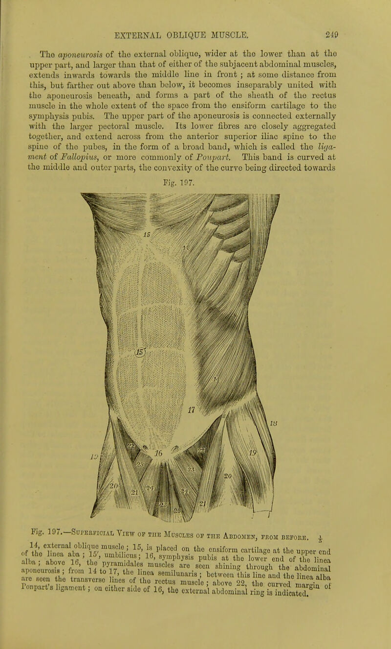 The a2)oneurosis of the external oblique, wider at the lower than at the upper part, and larger than that of either of the subjacent abdominal muscles, extends inwards towards the middle line in front ; at some distance from this, but farther out above than below, it becomes insepai'ably united with the aponeurosis beneath, and forms a part of the sheath of the rectus muscle in the whole extent of the space from the ensiform cartilage to the syni^jhysis pubis. The upper part of the ai^oneurosis is connected externally with the larger pectoral muscle. Its lower fibres are closely aggregated together, and extend across from the anterior superior iliac spine to the spine of the pubes, in the form of a broad band, which is called the liya- mmt of Fallop'ius, or more commonly of Fonjmrt. This band is curved at the middle and outer pai ts, the convexity of the curve being directed towards Fig. 197. Fig. 197.-SurKRrioiAL View of the Muscles op the Abdomen, from before. ^ ,r^ft'?'J°''\°^'Tr';°''f^?.: Pl'^<=^'1 °^ ensiform cartilage at the upper end a bn ZZ ll'X ' ^'^•'17'?; symphysis pubis at the lower end of the linea T +1' f V ' ^^^''6'* semilunaris ; between this line and the linea alba rnnnw' 1 ' t'-^°«^erse lines of the rectus muscle; above 22, the curved mardn o^ ronparts l.gamcnt; on either side of 16, the external abdominal ring is indicated?