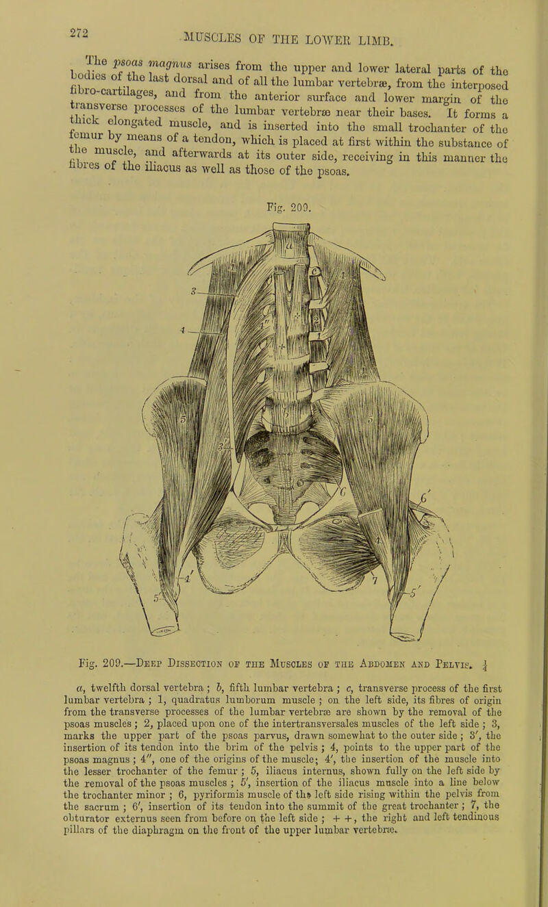 \Jtl ST TTT T''' ^^'^ PP^^- ''^^'1 ^^^^'■'^^ parts of the fihrn ^ 1-1 ^'^'^ ^^^^^-^ l^^^^- vertebra., from the interposed tibro-cartilages, and from the anterior surface aud lower margin of the transverse processes of the lumbar vertebrae near their bases. It forms a tiiick elongated muscle, and is inserted into the small trochanter of the lemur by means of a tendon, which is placed at first within the substance of the muscle, and afterwards at its outer side, receiving in this manner the nbres of the iliacus as well as those of the psoas. Fig. 209. Fig. 209.—Deep Dissection op the Muscles of the Abdomen and Pelvk-. ^ a, twelfth dorsal vertebra ; 6, fifth lumbar vertebra ; c, transverse process of the first lumbar vertebra ; 1, quadratus lumborum muscle ; on the left side, its fibres of origin from the transverse processes of the lumbar vertebrae are shown by the removal of the psoas muscles ; 2, placed upon one of the intertransversales muscles of the left side ; 3, marks the upper part of the psoas parvus, drawn somewhat to the outer side ; 3', the insertion of its tendon into the brim of the pelvis ; 4, points to the upper part of the psoas magnus ; 4, one of the origins of the muscle; 4', tlie insertion of the muscle into the lesser trochanter of the femur ; 5, iliacus internus, shown fully on the left side by the removal of the psoas muscles ; 5', insertion of the iliacus muscle into a line below the trochanter minor ; 6, pyriformis muscle of ths left side rising within the pelvis from the sacrum ; 6', insertion of its tendon into the summit of the great trochanter; 7, the obturator externus seen from before on the left side ; + +, the right aud left tendinous pillars of the diaphragm on the front of the upper lumbar vertebnc.