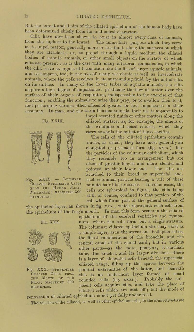 Fig. XXIX. But the extent and limits of the ciliated epithelium of the human body have been determined chiefly from its anatomical characters. Cilia have now been shown to exist in almost every class of animals, from the highest to tbe lowest. The immediate purpose which they serve is, to impel matter, generally more or less fluid, along the surfaces on which they ai-e attached ; or, to propel through a liquid medium the cihated bodies of minute animals, or other small objects on the surface of which cilia are present ; as is the case with many infusorial animalcules, in which the cilia serve as organs of locomotion like the fins of larger aquatic animals, and as happens, too, in the ova of many vertebrate as well as invertebrate animals, where the yelk revolves in its surrounding fluid by the aid of cilia on its surface. In many of the lower tribes of aquatic animals, the cilia acquire a high degree of importance : producing the flow of water over the surface of their organs of respiration, indispensable to the exercise of that function ; enabling the animals to seize their prey, or to swallow their food, and performing various other oflices of greater or less impoi-tance in their economy. In man, and the warm-blooded animals, their use is apjjarently to impel secreted fluids or other matters along the ciliated surface, as, for example, the mucus of the windpipe and nasal sinuses, which they carry towards the outlet of these cavities. The cells of the ciliated epithelium contain nuclei, as usual; they have most generally an elongated or prismatic form (fig. xxix.), like the particles of the colunmar epithelium, which they resemble too in arrangement but are often of greater length and more slender and pointed at their lower end. The cilia are attached to their broad or superficial end, each columnar particle bearing a tuft of these minute hair-like processes. In some cases, the cells are spheroidal in figure, the cilia being still, of course, confined to that portion of the cell which forms part of the general surface of the epithelial layer, as shown in fig. xxx., which represeuts such cells from the epithelium of the frog's mouth. In man this form occurs in the ciliated epithelium of the cerebral ventricles and tympa- num, where the cells form but a single stratum. The columnar ciliated epithelium also may exist as a simple layer, as in the uterus and Fallopian tubes, the finest ramifications of the bronchia, and the central canal of the spinal cord ; but in various other parts—as the nose, pharynx. Eustachian tube, the trachea and its larger divisions—there is a layer of elongated cells beneath the superficial ciliated range, filling up the spaces between the pointed extremities of the latter, and beneath this is an undermost layer formed of small rounded cells (fig. xxxi.)- Probably the sub- jacent cells acquire cilia, and take the place of ciliated cells which are cast off; but the mode of renovation of ciliated epithehum is not yet fully understood. The relation of the ciliated, as well as other epithelium cells, to the connective-tissue Fig. XXIX. — COLITMNAU Ciliated Epithelium Cells FKOM THE Human Nasal Membrane ; magnified 300 diameters. Fig. XXX. Fig. XXX.—Spheroidal CiLiATUD Cells from THE Mouth op the Frog ; magnified 300 diameters.