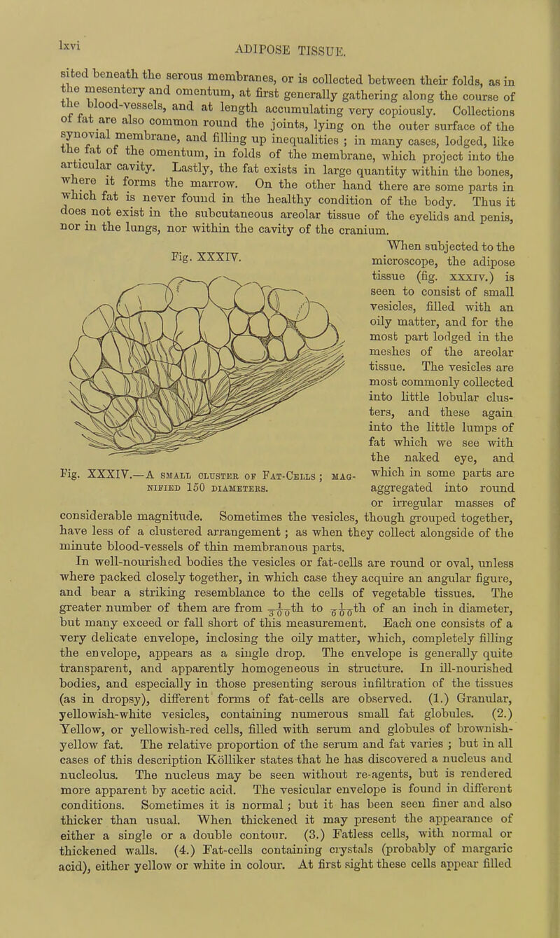 sited beneath tlie serous membranes, or is collected between their folds, as in the mesentery and omentum, at first generally gathering along the course of the blood-vessels, and at length accumulating very copiously. Collections ot tat are also common round the joints, lying on the outer surface of the synovial membrane, and filling up inequalities ; in many cases, lodged, like tue tat of the omentum, in folds of the membrane, which project into the articular cavity. Lastly, the fat exists in large quantity within the bones, where it forms the marrow. On the other hand there are some parts in which fat is never found in the healthy condition of the body. Thus it does not exist in the subcutaneous areolar tissue of the eyelids and penis, nor in the lungs, nor within the cavity of the cranium. When subjected to the Fig. XXXIV. microscope, the adipose tissue (fig. XXXIV.) is seen to consist of small vesicles, filled with an oily matter, and for the most part lodged in the meshes of the areolar tissue. The vesicles are most commonly collected into little lobular clus- ters, and these again into the little lumps of fat which we see with the naked eye, and which in some parts are aggregated into round or irregular masses of considerable magnitude. Sometimes the vesicles, though grouped together, have less of a clustered arrangement; as when they collect alongside of the minute blood-vessels of thin membranous parts. In well-nourished bodies the vesicles or fat-cells are round or oval, unless where packed closely together, in which case they acquire an angular figure, and bear a strikiag resemblance to the cells of vegetable tissues. The greater number of them are from -g-^oth to ■gjj^t'h of an inch in diameter, but many exceed or fall short of this measurement. Each one consists of a very delicate envelope, inclosing the oily matter, which, completely filling the envelope, appears as a single drop. The envelope is generally quite transparent, and apparently homogeneous in structure. In ill-nourished bodies, and especially in those presenting serous infiltration of the tissues (as in dropsy), different forms of fat-cells are observed. (1.) Granular, yellowish-white vesicles, containing numerous small fat globules. (2.) Yellow, or yellowish-red cells, filled with serum and globules of brownish- yellow fat. The relative proportion of the serum and fat varies ; but in all cases of this description KoUiker states that he has discovered a nucleus and nucleolus. The nucleus may be seen without re-agents, but is rendered more apparent by acetic acid. The vesicular envelope is found in different conditions. Sometimes it is normal; but it has been seen finer and also thicker than usual. When thickened it may present the appearance of either a single or a double contour. (3.) Fatless cells, with normal or thickened walls. (4.) Fat-cells containing crystals (probably of margaric acid), either yellow or white in colour. At first sight these cells appear filled Fig. XXXIV.—A SMALL CLUSTER OP FaT-CkLLS ; MAG NIFIED 150 DIAMETERS.