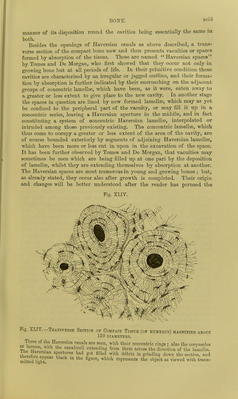 manner of its disposition round the cavities being essentially the same in both. Besides the openings of Haversian canals as above described, a trans- verse section of the compact bone now and then presents vacuities or spaces formed by absorption of the tissue. These are named Haversian spaces by Tomes and De Morgan, who first showed that they occur not only in growing bone but at all periods of life. In their primitive condition these cavities are characterised by an irregiilar or jagged outline, and their forma- tion by absorption is further indicated by their encroaching on the adjacent groups of concentric lamellso, which have been, as it were, eaten away to a greater or less extent to give place to the new cavity. In another stage the spaces in question are lined by new formed lamellae, which may as yet be confined to the peripheral part of the vacuity, or may fill it up in a concentric series, leaving a Haversian aperture in the middle, and in fact constituting a system of concentric Haversian lamellpe, interpolated or intruded among those previously existing. The concentric lamellae, which thus come to occupy a greater or less extent of the area of the cavity, are of course bounded exteriorly by segments of adjoining Haversian lameUoe, which have been more or less cut in upon in the excavation of the space. It has been further observed by Tomes and De Morgan, that vacuities may sometimes be seen which are being filled up at one part by the deposition of lamellae, whilst they are extending themselves by absorption at another. The Haversian spaces are most numerous in young and growing bones ; but, as already stated, they occur also after growth is completed. Their origin and changes will be better understood after the reader has perused the Fig, XLI7. Fig. XLIV.—Transverse Seotion of Compact Tissue (of nuMEnus) magnified about 150 DIAMETERS. ^r'^ulT, of the Haversian caTials are seen, with their concentric rings ; also the corpuscles or lacuna, with the canaliculi extending from them across the direction of the lamollte. thPrpfJrJr'* ••^P^>-t;-e8 had got filled with debris in grinding down the section, and Sed light^'''' ^'^^^^ i-epresents the object as viewed with trans-