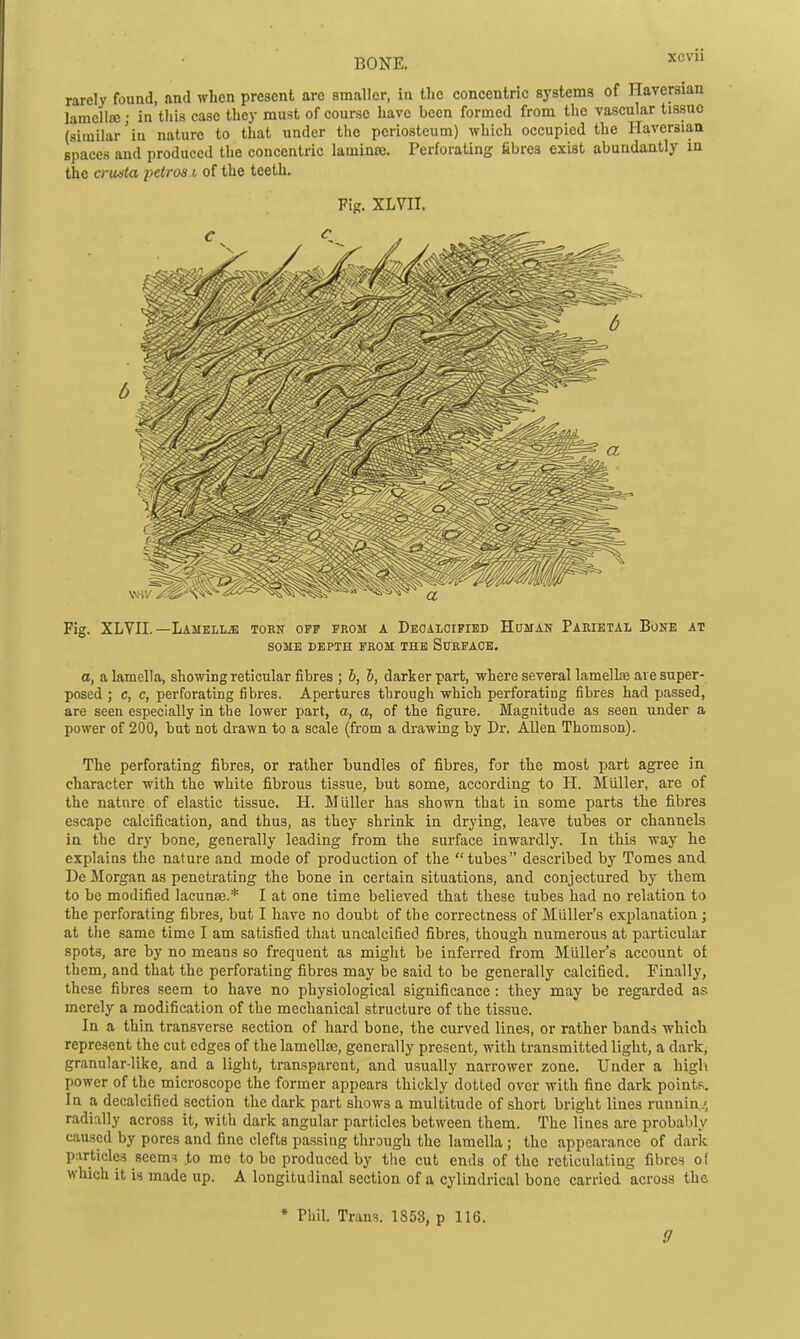 rarely found, and when present are smaller, in the concentric systems of Haversian lamcliaj; in this case they must of course have been formed from the vascular tissue (similar'in nature to that under the periosteum) which occupied the Haversiaa spaces and produced the concentric lamina}. Perforating fibres exist abundantly in the crwsta petros i of the teeth. Fig. XLVII. ^^^^ Fig. XLVII.—Lamella torn off prom a Deoaloified Human Parietal Bone at SOME DEPTH FROM THE SURFACE. a, a lamella, showing reticular fibres ; b, h, darker part, where several lamellis are super- posed ; c, c, perforating fibres. Apertures through which perforating fibres had passed, are seen especially in the lower part, a, a, of tlie figure. Magnitude as seen under a power of 200, but not drawn to a scale (from a drawing by Dr. Allen Thomson). The perforating fibres, or rather bundles of fibres, for the most part agree in character with the white fibrous tissue, but some, according to H. Miiller, are of the nature of elastic tissue. H. Miiller has shown that in some parts the fibres escape calcification, and thus, as they shrink in drying, leave tubes or channels in the dry bone, generally leading from the surface inwardly. In this way he explains the nature and mode of production of the tubes described by Tomes and De Morgan as penetrating the bone in certain situations, and conjectured by them to be modified lacunae.* I at one time believed that these tubes had no relation to the perforating fibres, but I have no doubt of the correctness of Miiller's explanation ; at the same time I am satisfied that uncalcified fibres, though numerous at particular spots, are by no means so frequent as might be inferred from Miiller's account of them, and that the perforating fibres may be said to be generally calcified. Finally, these fibres seem to have no physiological significance: they may be regarded as merely a modification of the mechanical structure of the tissue. In a thin transverse section of hard bone, the curved lines, or rather bands which represent the cut edges of the lamellae, generally present, with transmitted light, a dark, granular-like, and a light, transparent, and usually narrower zone. Under a higli power of the microscope the former appears thickly dotted over with fine dark points. In a decalcified section the dark part shows a multitude of short bright lines runnin..^ radially across it, with dark angular particles between them. The lines are probably caused by pores and fine clefts passing through the lamella; the appearance of dark p:irticle3 seems J,o me to be produced by the cut ends of the reticulating fibres ol which it is made up. A longitudinal section of a cylindrical bone carried across the * Phil. Trans. 1853, p 116.