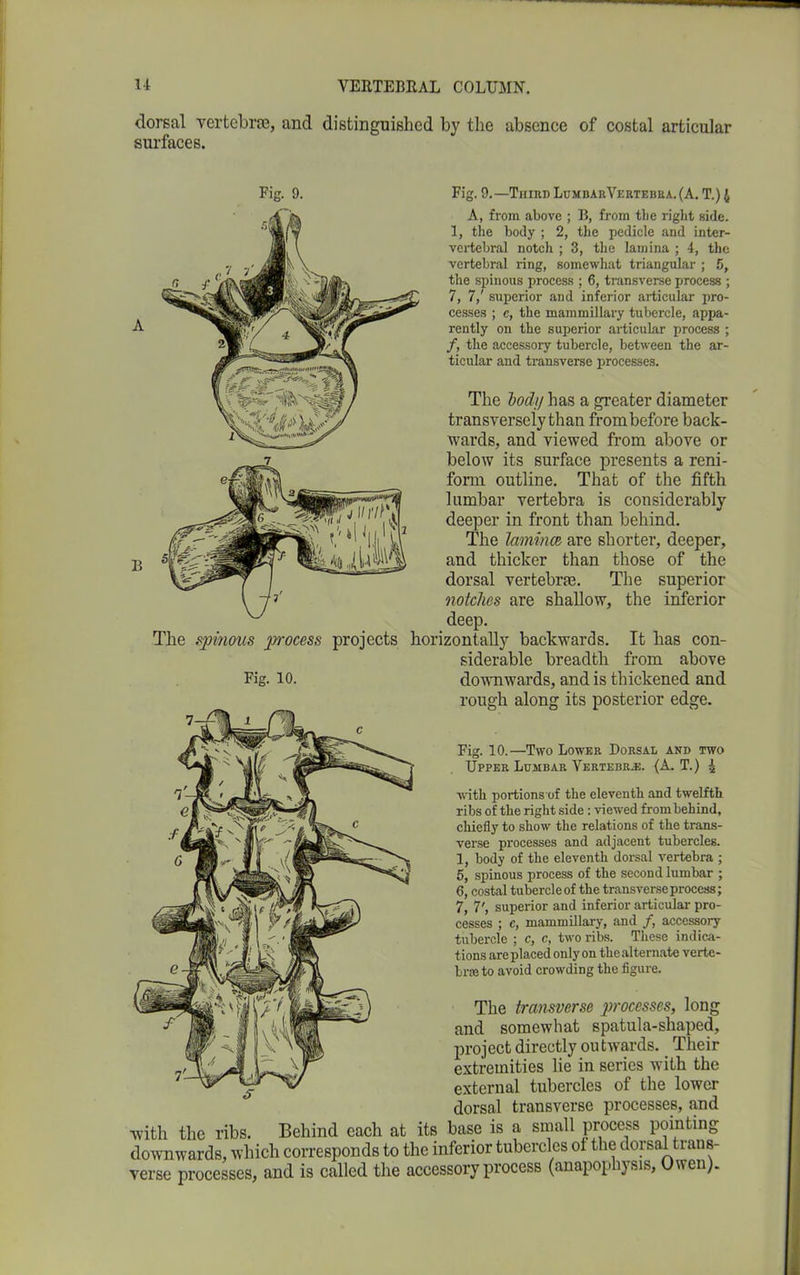 dorsal vertebra;, and distinguished by the absence of costal articular surfaces. Fig. 9. Fig.9.—ThirdLumbarVertebua.(A.T.)4 A, from above ; B, from tbe right side. 1, the body ; 2, the pedicle and inter- vertebral notch ; 3, the lamina ; 4, the vertebral ring, somewhat triangular ; 5, the spinous process ; 6, transverse process ; 7, 7/ superior and inferior articular pro- cesses ; e, the mammillary tubercle, appa- rently on the superior articular process ; /, the accessory tubercle, between the ar- ticular and transverse processes. The hodij has a greater diameter transversely than from before back- wards, and viewed from above or below its surface presents a reni- form outline. That of the fifth lumbar vertebra is considerably deeper in front than behind. The lamina, are shorter, deeper, and thicker than those of the dorsal vertebrae. The superior notches are shallow, the inferior deep. The spinous process projects horizontally backwards. It has con- siderable breadth from above Fig. 10. downwards, and is thickened and rough along its posterior edge. Fig. 10.—Two Lower Dorsal and two Upper Lumbar Vertebra. (A. T.) 4 with portions of the eleventh and twelfth ribs of the right side : viewed from behind, cliiefly to show the relations of the trans- verse processes and adjacent tubercles. 1, body of the eleventh dorsal vertebra ; 5, spinous process of the second lumbar ; 6, costal tubercle of the transverse process; 7, 7', superior and inferior articular pro- cesses ; c, mammillary, and /, accessory tubercle ; c, c, two ribs. These indica- tions are placed only on the alternate verte- bral to avoid crowding the figure. The transverse jwoccsses, long and somewhat spatula-sliaped, project directly outwards. Their extremities lie in series with the external tubercles of the lower dorsal transverse processes, and ,vith the ribs. Behind each at its base is a small process pointing lownwards, which corresponds to the inferior tubercles ol the dorsal trans- rerse processes, and is called the accessory process (anapopliysis, Owen).