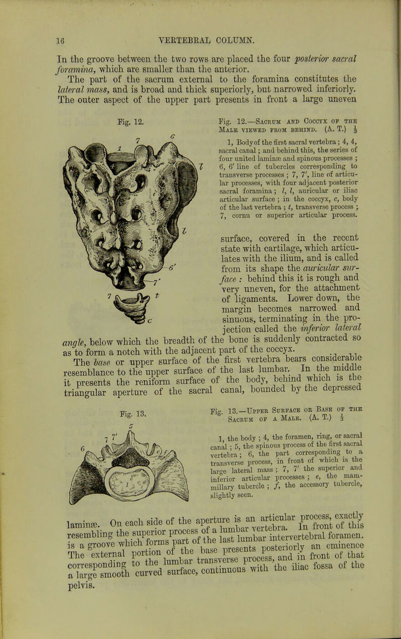 In the groove between the two rows are placed the four posterior sacral foramina, which arc smaller than the anterior. The part of the sacrum external to the foramina constitutes the lateral mass, and is broad and thick superiorly, but narrowed inferiorly. The outer aspect of the upper part presents in front a large uneven Fig. 12. Fig. 12.—Sacrum and Coccyx op the Male viewed from behind. (A. T.) i 1, Body of the first sacral vertebra; 4, 4, sacral canal; and behind this, the series of four united lamina; and spinous processes ; 6, 6' line of tubercles corresponding to transverse processes ; 7, T, line of articu- lar processes, with four adjacent posterior sacral foramina; l, l, auricular or iliac articular surface ; in the coccyx, c, body of the last vertebra ; t, transverse process ; 7, cornu or superior articular process. surface, covered in the recent state with cartilage, which articu- lates with the ilium, and is called from its shape the auricular sur- face : behind this it is rough and very uneven, for the attachment of ligaments. Lower down, the margin becomes narrowed and sinuous, terminating in the pro- jection called the inferior lateral angle, below which the breadth of the bone is suddenly contracted so as to form a notch with the adjacent part of the coccyx. The base or upper surface of the first vertebra bears considerable resemblance to the upper surface of the last lumbar. In the midd e it presents the reniform surface of the body, behind which is the triangular aperture of the sacral canal, bounded by the depressed Fig. 13, Fig. 13.—Upper Surface or Base of the Sacrum of a Male. (A. T.) g 1 the body ; 4, the foramen, ring, or sacral canal ; 5, the spinous process of the first sacral vertebra’; 6, the part corresponding to a transverse process, in front of which is the large lateral mass ; 7, 7' the superior and inferior articular processes ; c, the mam- millary tubercle ; /, the accessory tubercle, slightly seen. laminae On each side of the apertn^jn^Mar process, exactly resemblmg the supenOT process of intervertebral foramen. me “s the iliac fossa of the pelvis.