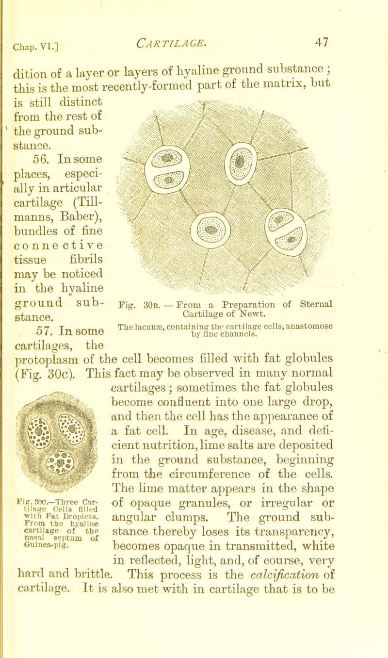 Fig. 30b. From a Preparation Cartilage o£ Newt. of Sternal dition of a layer or layers of hyaline ground substance; this is the most recently-formed part of the matrix, but is still distinct from the rest of \ ^-T^, ^ / , the ground sub- stance. 56. In some places, especi- ally in articular cartilage (Till- manns, Baber), bundles of fine conne ctive tissue fibrils may be noticed in the hyaline ground sub- stance. 57. In some cartilages, the protoplasm of the cell becomes filled with fat globules (Fig. 30c), This fact may be observed in many normal cartilages; sometimes the fat globules become confluent into one large drop, and then the cell has the appearance of a fat cell. In age, disease, and defi- cient nutrition, lime salts are deposited in the ground substance, beginning from the circumference of the cells. The lime matter appears in the shape of opaque granules, or irregular or angular clumps. The ground sub- stance thereby loses its transparency, becomes opaque in transmitted, white in reflected, light, and, of course, very hard and brittle. This process is the calcification of cartilage. It is also met with in cartilage that is to be The lacunffi, containing the cartilage cells, anastomose by line channels. Fie. 30C.—Three Car- tihiBe Cells niled with Fat Droplets, From the hyaline cartilage o( the nasal septum of Guinea-pig,