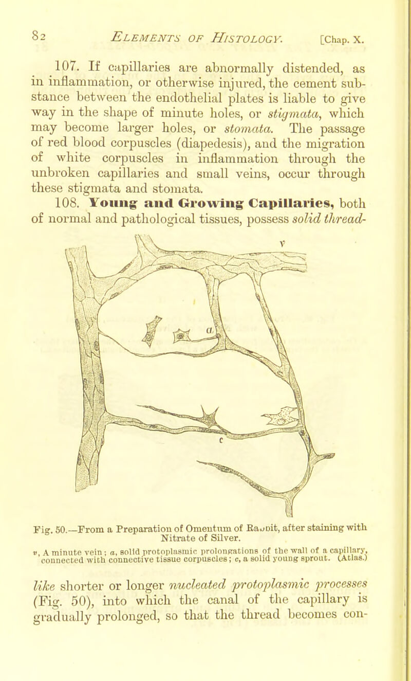 [Chap. X. 107. If capillaries are abnormally distended, as in inflammation, or otherwise injured, the cement sub- stance between the endothelial ^Dlates is liable to give way in the shape of minute holes, or stigmata, which may become larger holes, or stomata. The passage of red blood corpuscles (diapedesis), and the migration of white corpuscles in inflammation through the unbroken capillaries and small veins, occur through these stigmata and stoinata, 108. Young- and Growing; Capillaries, both of normal and pathological tissues, possess solid thread- Fig. 50. From a Preparation of Omeutum of Eaooit, after staining with Nitrate of SUver. V A minute vein; a, solid protnplasmir prolonftations of tbe wall of a capillary, 'connected witli connective tissue corpuscles; c, a solid young sprout. tAtlas.) like shorter or longer nucleated protoplasmic processes (Fig. 50), into which the canal of the capillary is gradually prolonged, so that the thread becomes con-