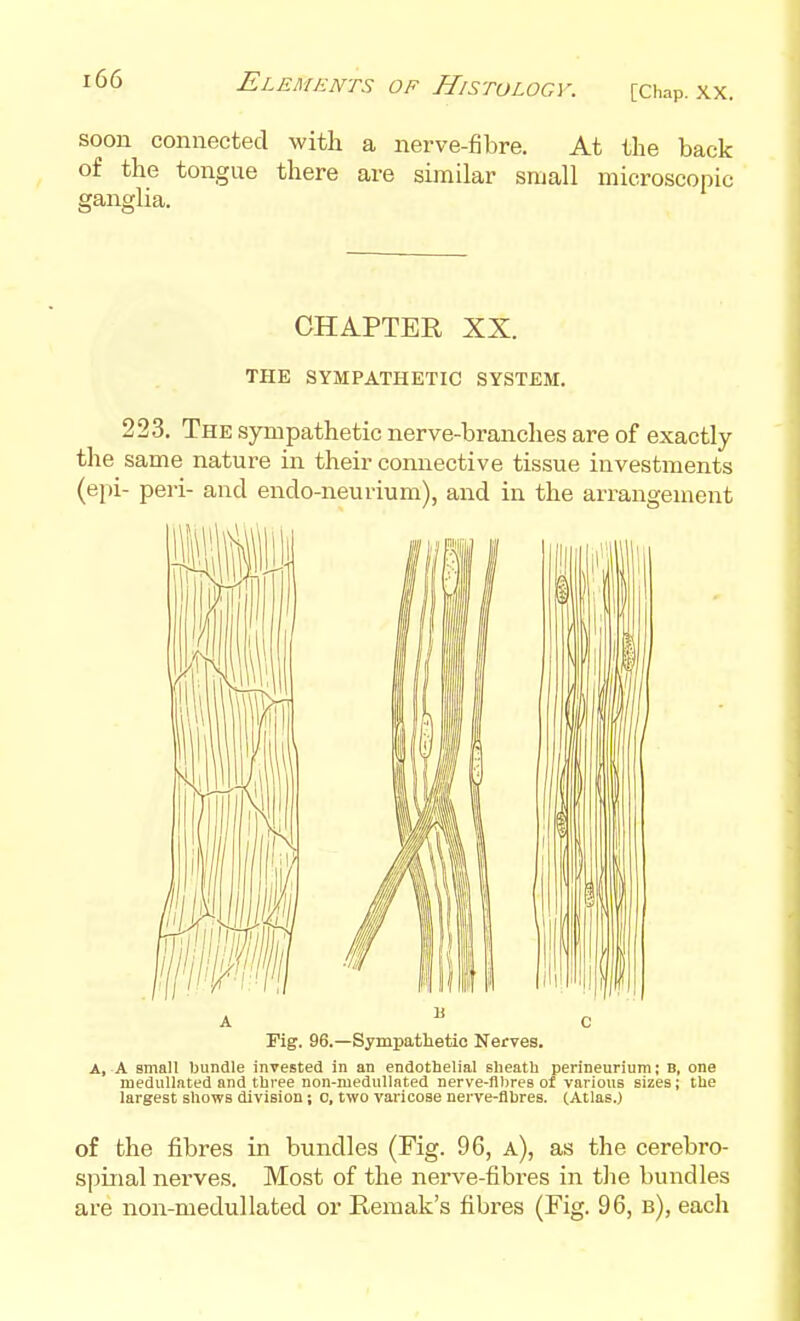 Elements of Histology. [Chap. XX. soon connected with a nerve-fibre. At the back of the tongue there are similar small microscopic ganglia. CHAPTER XX. THE SYMPATHETIC SYSTEM. 223, The sympathetic nerve-branches are of exactly the same nature in their connective tissue investments {ei)i- peri- and endo-neurium), and in the arrangement Fig. 96.—Sympathetic Nerves. A, A small bundle invested in an endothelial sheath perineurium; b, one meduUated and three non-meduUated nerve-flbres of various sizes; the largest shows division; 0, two varicose nerve-flbres. (Atlas.) of the fibres in bundles (Fig. 96, a), as the cerebro- spinal nerves. Most of the nerve-fibres in tlie bundles are non-medullated or Remak's fibres (Fig. 96, b), each