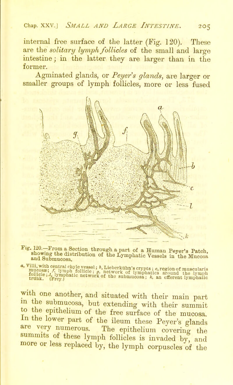 internal free surface of the latter (Fig. 120). These are the solitary lymph follicles of the small and large intestine; in the latter they are larger than in the former. Agminated glands, or Peyer's glands, are larger or smaller gi'oups of lymph follicles, more or less fused ^'^'^^^^I?^ a part of a Human Peyer's Patch, and^f mucosa the Lymphatic Vessels in the Mucosa ^mnfol^- TV^mA'\lm?^f '• Lieberkuhn-8 crypts ; region of mu8cularis fomcfe ^ hSati?^^^^^^^ lymphatics around the lymph trunk (Pre™) network of the submucoaa; *. an efferent lymphatic with one another, and situated with their main part m the submucosa, but extending with their summit to the epithelium of the free surface of the mucosa. In the lower part of the ileum these Peyer's glands are very numerous. The epithelium covering the summits of these lymph follicles is invaded by^ and more or less replaced by, the lymph corpuscles of the