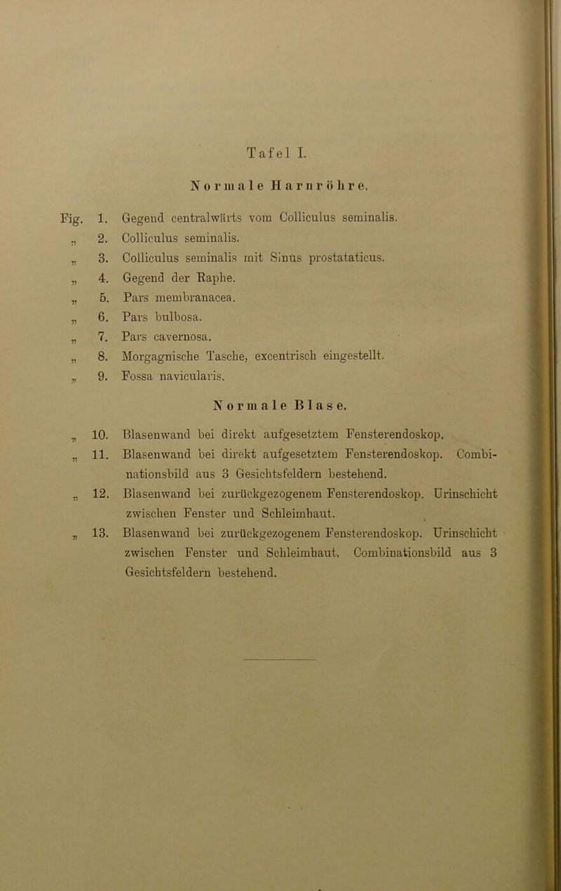 Fi g. v v V V V V y> 1. 2. 3. 4. 5. 6. 7. 8. 9. n r) io. n. 7) 12. 7? 13. No r in a 1 e Harnr ölire. Gegend centralwärts vom Colliculus seminalis. Colliculus seminalis. Colliculus seminalis mit Sinüs prostataticus. Gegend der Raphe. Pars membranacea. Pars bulbosa. Pars cavernosa. Morgagnische Tasche, excentrisch eingestellt. Fossa navicularis. N o r m a 1 e Blas e. Blasenwand bei direkt aufgesetztem Fensterendoskop. Blasenwand bei direkt aufgesetztem Fensterendoskop. Combi- nationsbild aus 3 Gesichtsfeldern bestehend. Blasenwand bei zurückgezogenem Fensterendoskop. Urinschicht zwischen Fenster und Schleimhaut. Blasenwand bei zurückgezogenem Fensterendoskop. Urinschicht zwischen Fenster und Schleimhaut. Combinationsbild aus 3 Gesichtsfeldern bestehend.