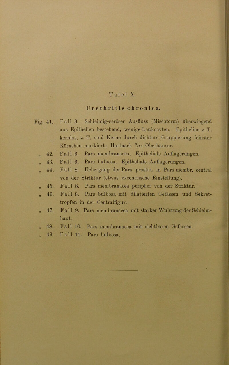 Urethritis chronica. Fig. 41. Fall 3. Schleimig-seröser Ausfluss (Mischform) überwiegend aus Epithelien bestehend, wenige Leukocyten. Epithelien z. T. kernlos, z. T. sind Kerne durch dichtere Gruppierung feinster Körnchen markiert; Hartnack 3/?; Oberhäuser. „ 42. Fall 3. Pars membranacea. Epitheliale Auflagerungen. „ 43. Fall 3. Pars bulbosa. Epitheliale Auflagerungen. „ 44. Fall 8. Uebergang der Pars prostat. in Pars membr. central von der Striktur (etwas excentrische Einstellung). „ 45. Fall 8. Pars membranacea peripher von der Striktur. „ 46. Fall 8. Pars bulbosa mit diktierten Gefässen und Sekret- tropfen in der Centralfigur. „ 47. Fall 9. Pars membranacea mit starker Wulstung der Schleim- haut. „ 48. Fall 10. Pai-s membranacea mit sichtbaren Gefässen. ., 49. Fall 11. Pars bulbosa.