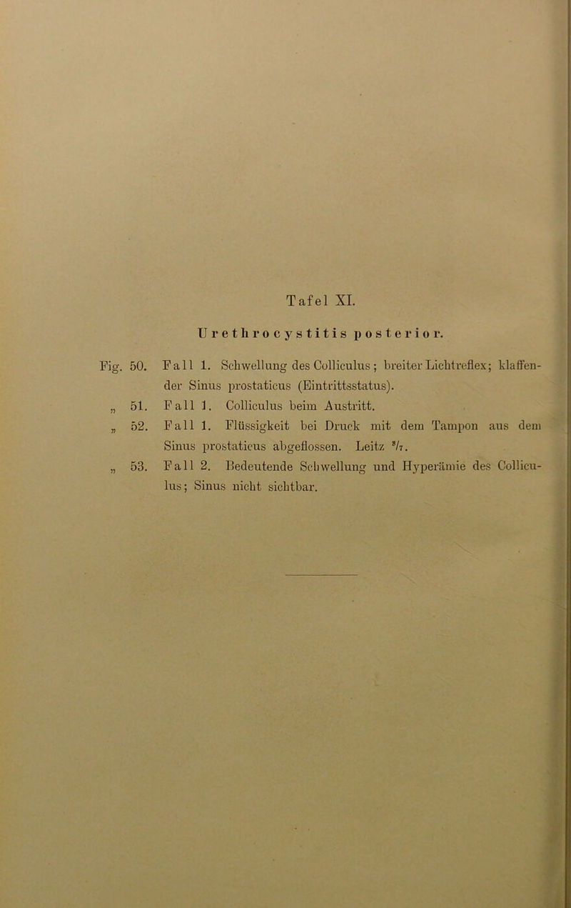 Urethrocystitis posterior. Fig. 50. Fall 1. Schwellung des Colliculus; breiter Lichtreflex; klaffen- der Sinus prostaticus (Eintrittsstatus). „ 51. Fall 1. Colliculus beim Austritt. „ 52. Fall 1. Flüssigkeit bei Druck mit dem Tampon aus dem Sinus prostaticus abgeflossen. Leitz sh. „ 53. Fall 2. Bedeutende Schwellung und Hyperämie des Collicu- lus; Sinus nicht sichtbar.