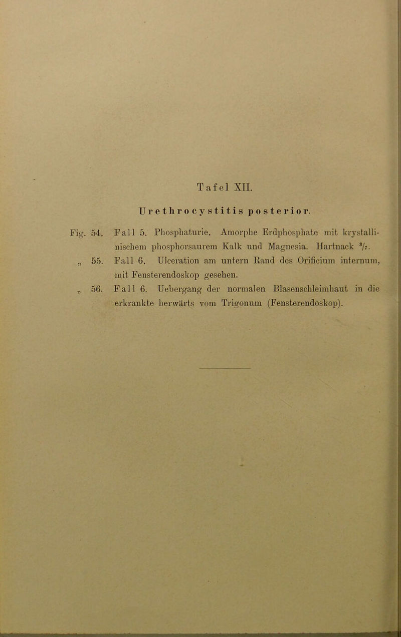 Uretlirocystitis posterior. Fig. 54. Fall 5. Phosphaturie. Amorphe Erdphosphate mit krystalli- nischem phosphorsaurem Kalk und Magnesia. Hartnack *h. „ 55. Fall 6. Ulceration am untern Rand des Orificium infernum, mit Fensterendoskop gesehen. „ 56. Fall 6. Uebergang der normalen Blasenschleimhaut in die erkrankte herwärts vom Trigonum (Fensterendoskop).