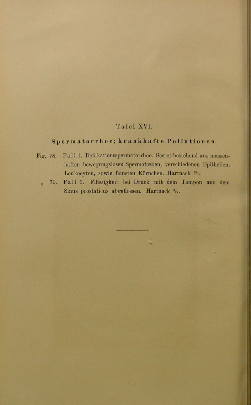 Spermatorrhoe; krankhafte Pollutionen. Fig. 78. Fallt. Defäkationsspermatorrhoe. Secret bestehend aus massen- haften bewegungslosen Spermatozoen, verschiedenen Epithelien, Leukocyten, sowie feinsten Körnchen. Hartnack 3h. „ 79. Fall 1. Flüssigkeit bei Druck mit dem Tampon aus dem Sinus prostaticus abgeflossen. Hartnack sh.