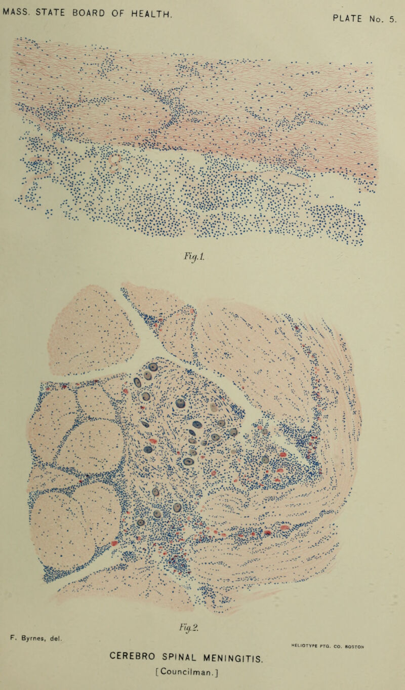 HELIOTYPE PTG. CO. BOSTON CEREBRO SPINAL MENINGITIS.