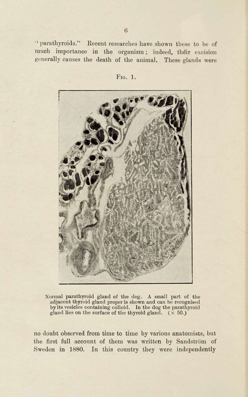 '‘parathyroids.” Kecent researches have shown these to be of much importance in the organism; indeed, th^ir excision generally causes the death of the animal. These glands were Fig. 1. Normal parathyroid gland of the dog. A small part of the adjacent thyroid gland proper is shown and can be recognised by its vesicles containing colloid. In the dog the parathyroid gland lies on the surface of the thyroid gland. ( x 50.) no doubt observed from time to time by various anatomists, but the first full account of them was written by Sandstrbm of Sweden in 1880. In this country they were independently