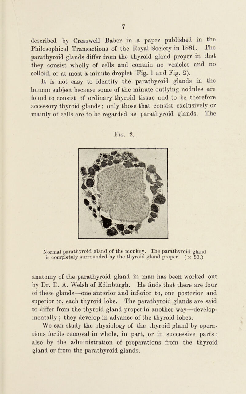 described by Cresswell Baber in a paper published in the Philosophical Transactions of the Royal Society in 1881. The parathyroid glands differ from the thyroid gland proper in that they consist wholly of cells and contain no vesicles and no colloid, or at most a minute droplet (Fig. 1 and Fig. 2). It is not easy to identify the parathyroid glands in the human subject because some of the minute outlying nodules are found to consist of ordinary thyroid tissue and to be therefore accessory thyroid glands ; only those that consist exclusively or mainly of cells are to be regarded as parathyroid glands. The Fig. 2. Normal parathyroid gland of the monkey. The parathyroid gland is completely surrounded by the thyroid gland proper, (x 50.) anatomy of the parathyroid gland in man has been worked out by Dr. D. A. Welsh of Edinburgh. He finds that there are four of these glands—one anterior and inferior to, one posterior and superior to, each thyroid lobe. The parathyroid glands are said to differ from the thyroid gland proper in another way—develop- mentally ; they develop in advance of the thyroid lobes. We can study the physiology of the thyroid gland by opera- tions for its removal in whole, in part, or in successive parts ; also by the administration of preparations from the thyroid gland or from the parathyroid glands.