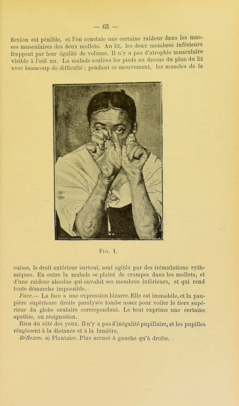 flexion est pénible, et l'on constate une certaine raideiii' dans les mas- ses musculaires des deux mollets. Au lit, les deux membres inférieurs frappent par leur égalité de volume. Il n'y a pas d'atrophie musculaire visible à l'œil nu. La malade soulève les pieds au dessus du plan du lit avec beaucoup de difliculté : pendant ce mouvement, les muscles de la FlG. 1. cuisse, le droit antérieur surtout, sont agités par des trémulations ryth- miques. En outre la malade se plaint de crampes dans les mollets, et d'une raideur absolue qui envahit ses membres inférieurs, et qui rend toute démarche impossible. Face.— La face a une expression bizarre. Elle est immabile, etla pau- pière supérieure droite paralysée toml)e assez pour voiler le tiers supé- rieur du globe oculaire correspondant. Le tout exprime une certaine apathie, ou résignation. Rien du côté des yeux. Il n'y a pas d'inégalité pupillaire, et les pupilles réagissent à la distance et à la lumière. Réflexeii. a) Plantaire. Plus accusé à gauche qu'à droite.