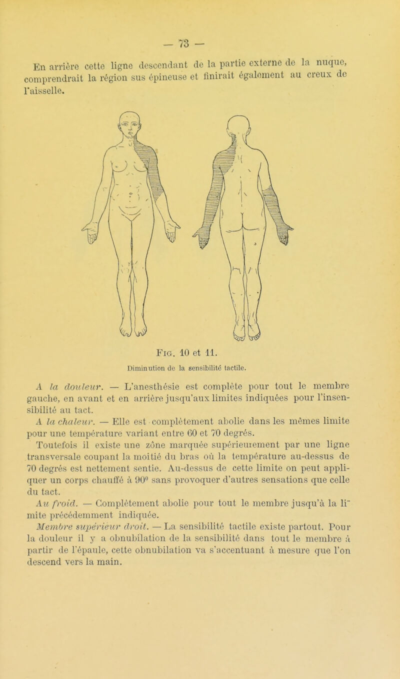 En arrière cette ligne descendant de la partie externe de la nuque, comprendrait la région sus épineuse et finirait également au creux de Taisselle. FiG. 10 et 11. Diminution de la sensibilité tactile. A la douleur. — L'anesthésie est complète pour tout le membre gauche, en avant et en arrière jusqu'aux limites indiquées pour l'insen- sibilité au tact. A la chaleur. — Elle est complètement abolie dans les mêmes limite pour une température variant entre 60 et 70 degrés. Toutefois il existe une zone marquée supérieuiement par une ligne transversale coupant la moitié du bras où la température au-dessus de 70 degrés est nettement sentie. Au-dessus de cette limite on peut appli- quer un corps chauffé à DO** sans provoquer d'autres sensations que celle du tact. Au froid. — Complètement abolie pour tout le membre jusqu'à la li mite précédemment indiquée. Membre supérieur droit. —La sensibilité tactile existe partout. Pour la douleur il y a obnubilation de la sensibilité dans tout le membre à partir de l'épaule, cette obnubilation va s'accentuant à mesure que l'on descend vers la main.