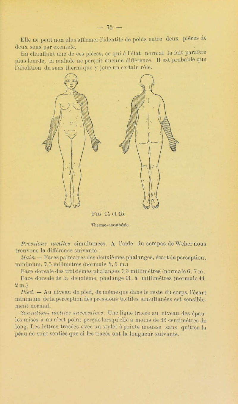 Elle ne peut non plus affirmer ridentité de poids entre deux pièces de deux sous par exemple. En chauffant une de ces pièces, ce qui à l'état normal la fait paraître plus lourde, la malade ne perçoit aucune diJierence. Il est i)robable que l'abolition du sens thernii({ue y joue un certain rôle. FiG. 14 et 15. Thenno-anesthésie. Pressions lactiles simultanées. A l'aide du compas de Weber nous trouvons la différence suivante : Main.— Faces palmaires des deuxièmes piialanges, écart de perception, minimum, 7,5 milimétres (normale 4, 5 m.) Face dorsale des troisièmes phalanges 7,3 millimètres (normale G, 7 m. Face dorsale de la deuxième phalange 11, 4 millimètres (normale 11 2 m.) Pied. — Au niveau du pied, de môme que dans le reste du corps, l'écart minimum de la perception des pressions tactiles simultanées est sensible- ment normal. Sensations lacli/es snrcessives. Une ligne tracée au niveau des épau- les mises à nu n'est point perçue lorsqu'elle a moins de 12 centimètres de long. Les lettres tracées avec un stylet à pointe mousse sans quitter la peau ne sont senties que si les tracés ont la longueur suivante.
