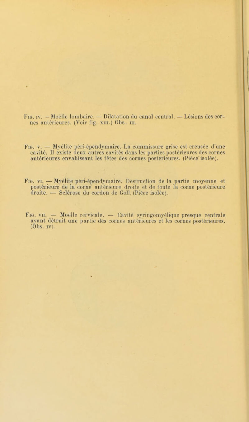 nes anlérieures. (Voir lig. xm.) Obs. m. FiG. V. — Myélite péri-épendymaire. La commissure grise est creusée d'une cavité. Il existe deux aulres cavités dans les parties postérieures des cornes antérieures envahissant les tètes des cornes postérieures. (Pièce isolée). FiG. VI. — Myélite péri-épendymaire. Destruction de la partie moyenne et postérieure de la corne antérieure droite et de toute la corne postérieure droite. — Sclérose du cordon de Coll. (Pièce isolée). FiG. vu. — Moelle cervicale. — Cavité syringomyélique presque centrale ayant détruit une partie des cornes antérieures el les cornes postérieures. (Ôbs. IV).