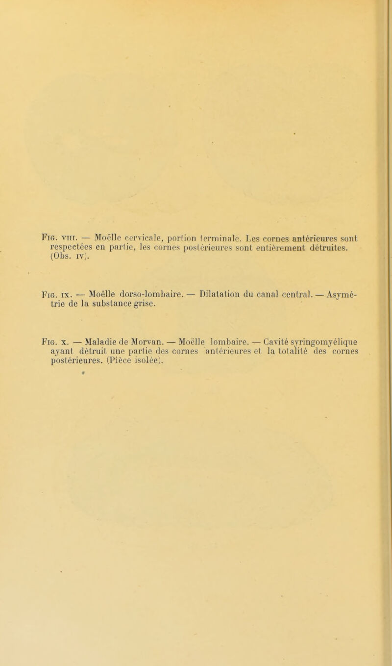 respectées en parlie, les cornes poslérieures sonL entièrement détruites. (Obs. iv). FiG. IX. — Moëlle dorso-lombaire. — Dilatation du canal central. — Asymé- trie de la substance grise. FiG. X. — Maladie de Morvan. — Moëlle lombaire. — Cavité syringomyélique ayant détruit une parlie des cornes antérieures et la totalité des cornes postérieures. (Pièce isolée).
