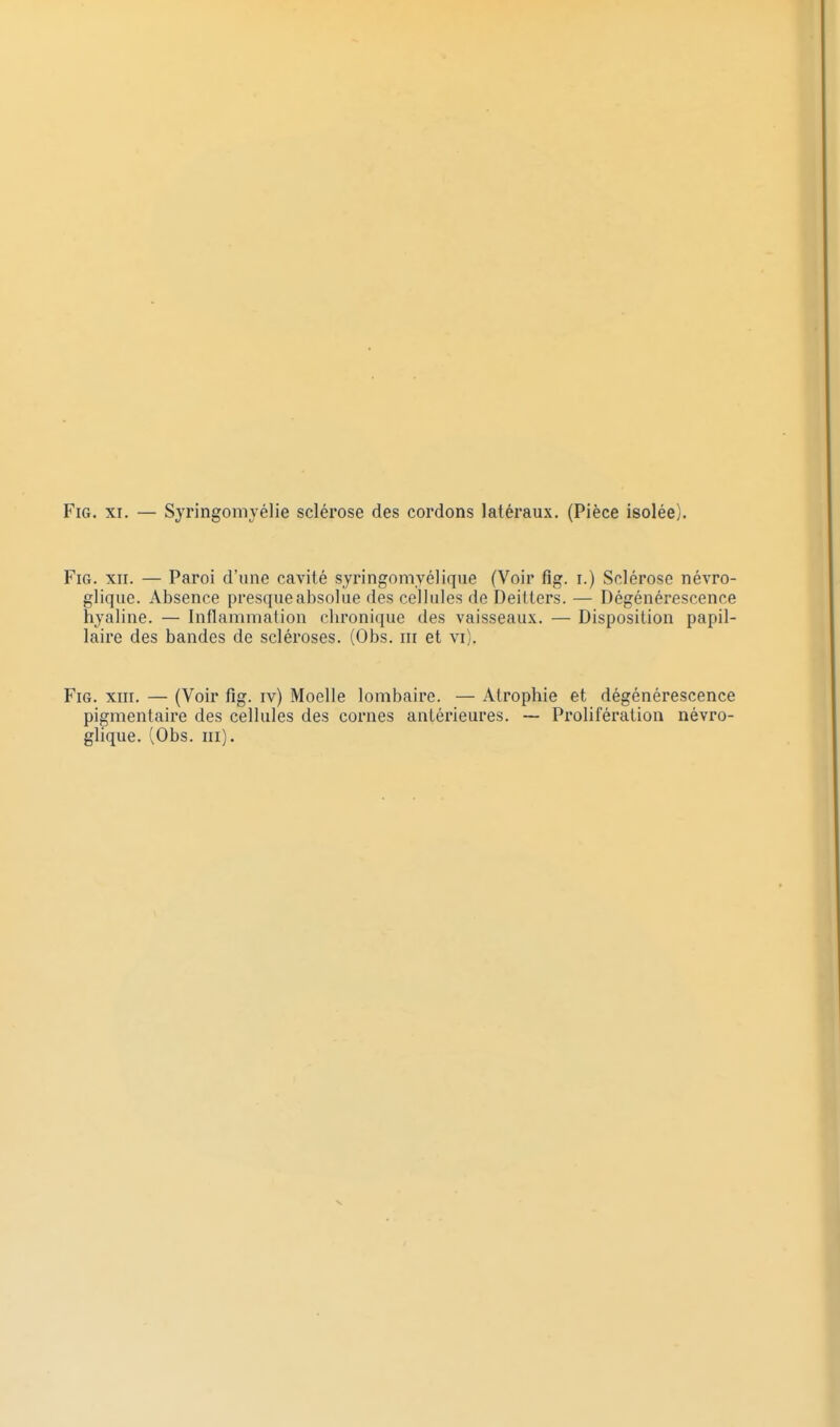 FiG. XII. — Paroi d'une cavité syringomyélique (Voir fig. i.) Sclérose névro- glique. Absence presque absolue des cellules de Deillers. — Dégénérescence hyaline. — Inflammation chronique des vaisseau.x. — Disposition papil- laire des bandes de scléroses. (Obs. m et vi). Fig. XIII. — (Voir fîg. iv) Moelle lombaire. — Atrophie et dégénérescence pigmentaire des cellules des cornes antérieures. ~ Prolifération névro- glique. (Obs. m).