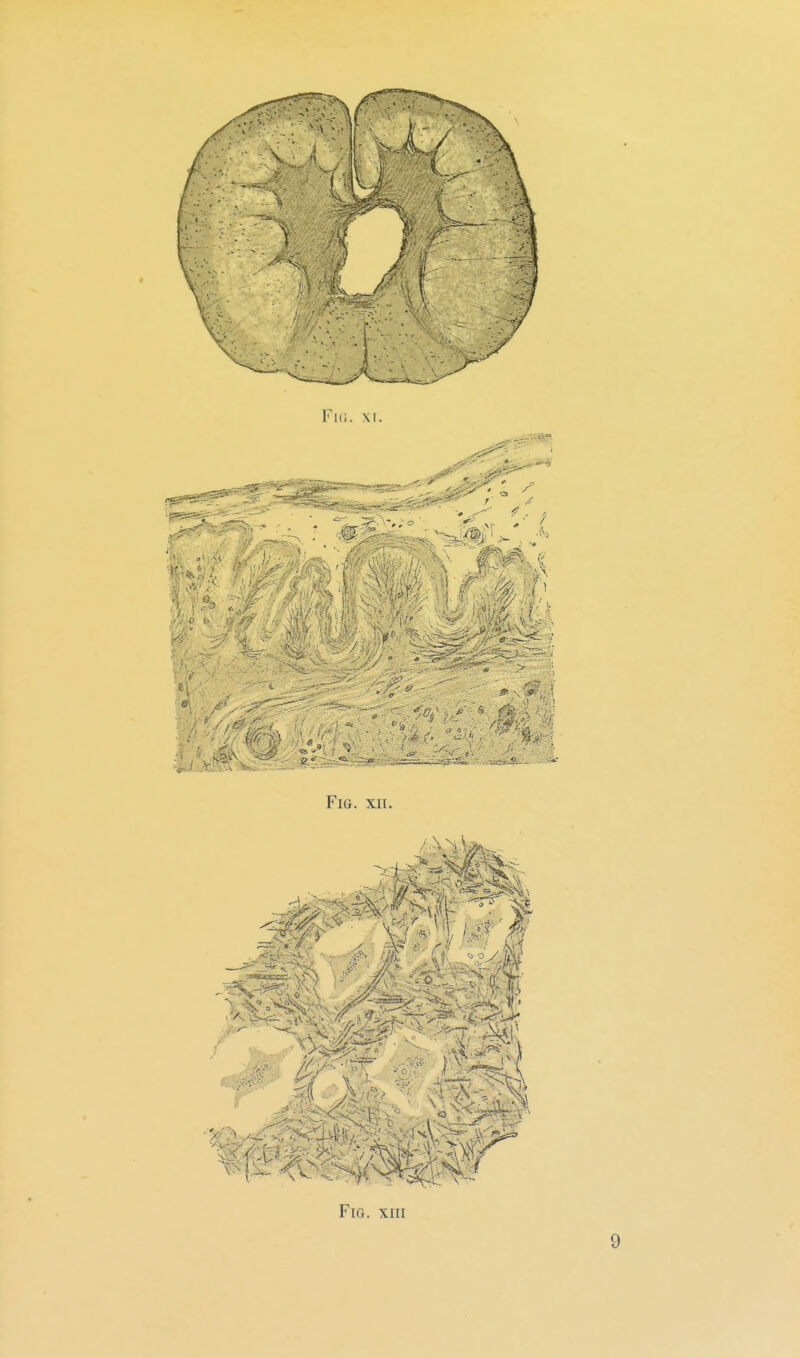 Fui. \\. ■h FiG. XII. FiG. XIII