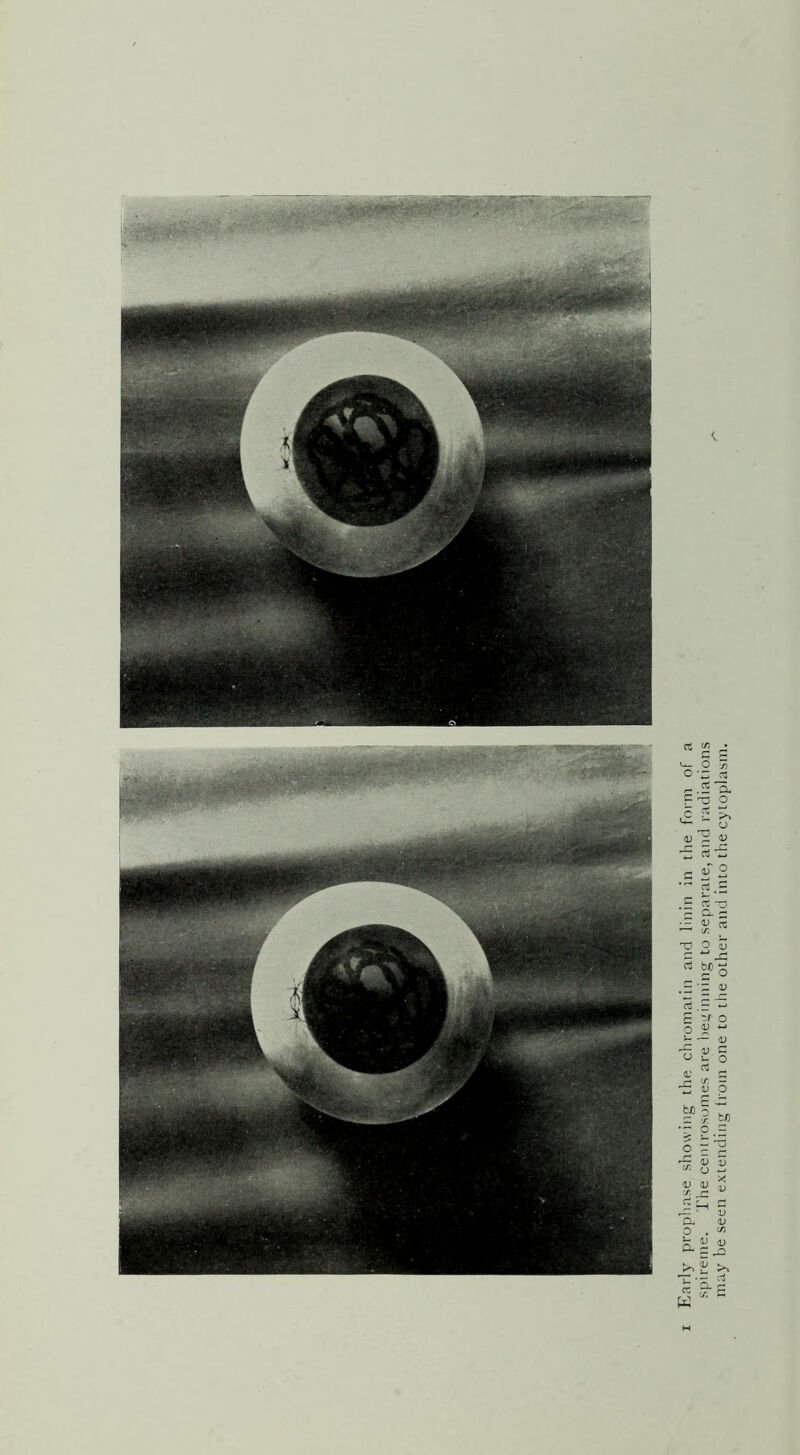 Early prophase showing the chromatin and linin in the form of a spireme. The centrosomes are beginning to separate, and radiations may be seen extending from one to the other and into the cytoplasm.