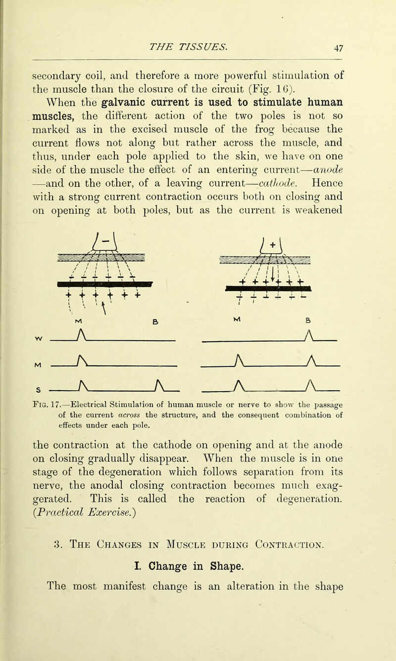 secondary coil, and therefore a more powerful stimulation of the muscle than the closure of the circuit (Fig. 10). When the galvanic current is used to stimulate human muscles, the different action of the two poles is not so marked as in the excised muscle of the frog because the current flows not along but rather across the muscle, and thus, under each pole applied to the skin, we have on one side of the muscle the effect of an entering current—anode —and on the other, of a leaving current—cathode. Hence with a strong current contraction occurs both on closing and on opening at both poles, but as the current is weakened M a A A A M /' / / I 1 \ \ -fi- 4- -1-^+ i V ■ B> k _L J. 1 1 M -i. ^ ^ i- B A . V A A V . A _ /\ Fig. 17.—Electrical Stimulation of human muscle or nerve to show the passage of the current across the structure, and the consequent combination of effects under each pole. the contraction at the cathode on opening and at the anode on closing gradually disappear. When the muscle is in one stage of the degeneration which follows separation from its nerve, the anodal closing contraction becomes much exag- gerated. This is called the reaction of degeneration. (Practical Exercise.) 3. The Changes in Muscle during Contraction. I. Change in Shape. The most manifest change is an alteration in the shape