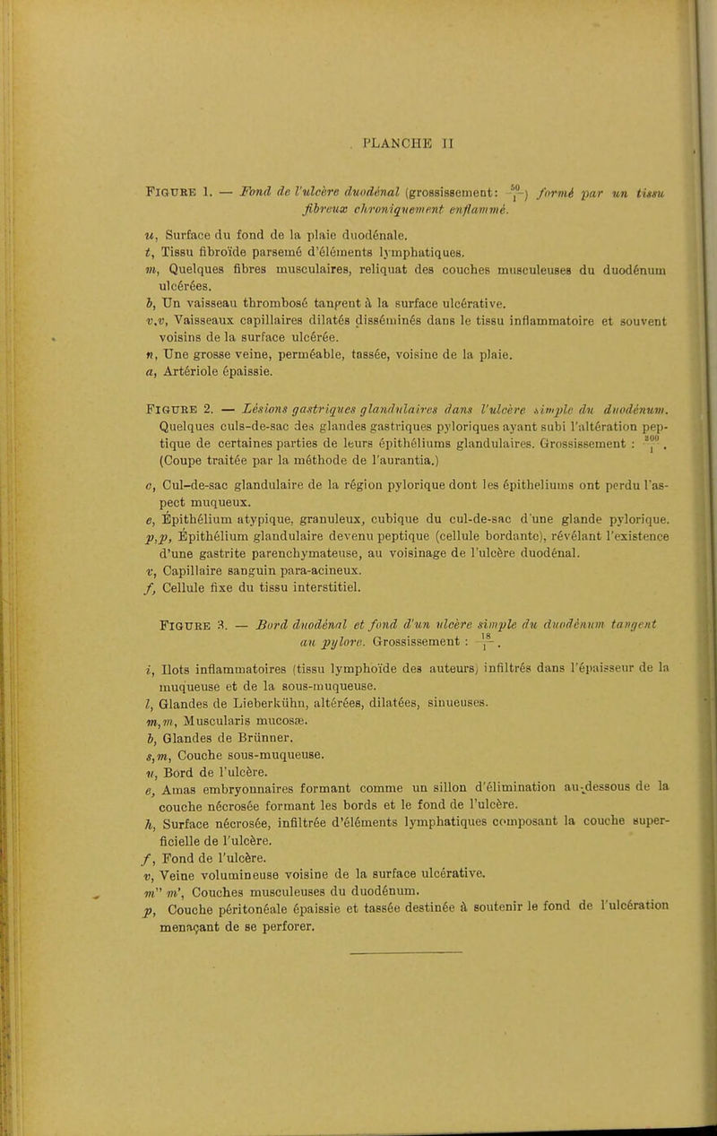 Figure l. — Fond de l'ulcère duodénal (grossissement: formé imr un tissu fibreux chroniquement enflammé. u, Surface du fond de la plaie duodénale. t, Tissu fibroïde parsemé d'éléments lymphatiques. 711, Quelques fibres musculaires, reliquat des couches musculeuseB du duodénum ulcérées. b, Un vaisseau thrombosé tanpent à la surface ulcérative. v.v, Vaisseaux capillaires dilatés disséminés dans le tissu inflammatoire et souvent voisins de la surface ulcérée. «, Une grosse veine, perméable, tassée, voisine de la plaie. a, Artériole épaissie. FlOUEE 2. — Lésions gastriques glandulaires dans l'uloère .simple du duodénum. Quelques culs-de-sac des glandes gastriques pyloriques ayant subi l'altération pep- tique de certaines parties de leurs épithéliums glandulaires. Grossissement : J. (Coupe traitée par la méthode de l'aurantia.) c, Cul-de-sac glandulaire de la région pylorique dont les épithéliums ont perdu l'as- pect muqueux. e, Épithélium atypique, granuleuXj cubique du cul-de-sac d'une glande pylorique. p,p, Epithélium glandulaire devenu peptique (cellule bordante), révélant l'existence d'une gastrite parenchymateuse, au voisinage de l'ulcère duodénal. V, Capillaire sanguin para-acineux. f, Cellule fixe du tissu interstitiel. FiGUKE 3. — Bord duodénal et fond d'un ulcère simple du duodénum tangent au pylore. Grossissement : 'j- . i, Ilots inflammatoires (tissu lymphoïde des auteurs) infiltrés dans l'épaisseur de la muqueuse et de la sous-muqueuse. l, Glandes de Lieberkûhu, altérées, dilatées, sinueuses. m,m, Muscularis mucosse. b, Glandes de Brunner. s,m, Couche sous-muqueuse. V, Bord de l'ulcère. e. Amas embryonnaires formant comme un sillon d'élimination au-^dessous de la couche nécrosée formant les bords et le fond de l'ulcère. h, Surface nécrosée, infiltrée d'éléments lymphatiques composant la couche super- ficielle de l'ulcère. /, Fond de l'ulcère. V, Veine volumineuse voisine de la surface ulcérative. ot m\ Couches musculeuses du duodénum. p, Couche péritonéale épaissie et tassée destinée à soutenir le fond de l'ulcération menaçant de se perforer.