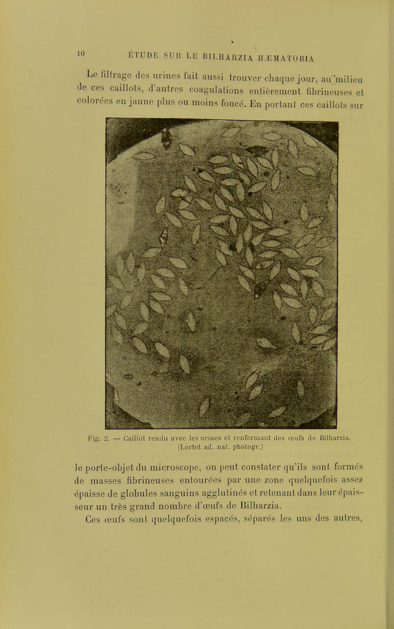 Le Altragc des urines fait aussi trouve)' chaque jour, au milieu de ces caillots, d'autres coagulations entièrement fibrineuses et colorées en jaune plus ou moins foncé. En portant ces caillots sur Fig. 2. — Caillot leuilu avec les ui-ines et renfermaut des œufs de Bilharzia. (Lortet ad. nat. photogr.) le porte-objet du microscope, on peut constater qu'ils sont formés de masses fibrineuses entourées par une zone quelquefois assez épaisse de globules sanguins agglutinés et retenant dans leur épais- seur un très grand nombre d'œufs de Bilharzia. Ces œufs sont quelquefois espacés, séparés les uns des autres,