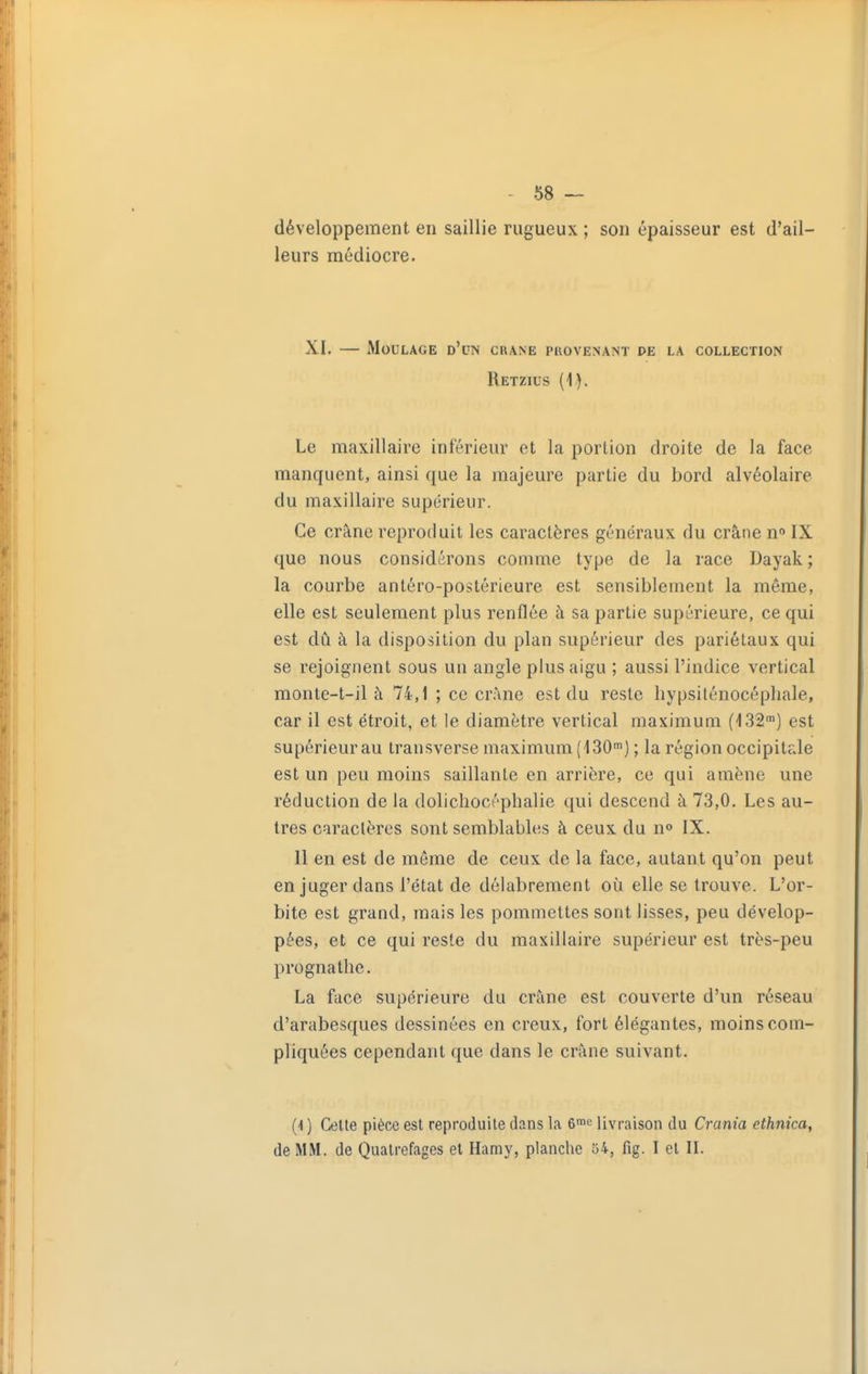 développement en saillie rugueux ; son épaisseur est d'ail- leurs médiocre. XI. — Moulage d'un crâne provenant de la collection Retzius (1). Le maxillaire inférieur et la portion droite de la face manquent, ainsi que la majeure partie du bord alvéolaire du maxillaire supérieur. Ce crâne reproduit les caractères généraux du crâne n<» IX que nous considérons comme type de la race Dayak ; la courbe anléro-postérieure est sensiblement la même, elle est seulement plus renflée à sa partie supérieure, ce qui est dû à la disposition du plan supérieur des pariétaux qui se rejoignent sous un angle plus aigu ; aussi l'indice vertical monte-t-il à 74,1 ; ce crâne est du reste hypsiténocépliale, car il est étroit, et le diamètre vertical maximum (132') est supérieur au transverse maximum (130') ; la région occipitale est un peu moins saillante en arrière, ce qui amène une réduction de la dolichocéphalie qui descend à 73,0. Les au- tres caractères sont semblables à ceux du n» IX. Il en est de même de ceux de la face, autant qu'on peut en juger dans l'état de délabrement où elle se trouve. L'or- bite est grand, mais les pommettes sont lisses, peu dévelop- pées, et ce qui reste du maxillaire supérieur est très-peu prognathe. La face supérieure du crâne est couverte d'un réseau d'arabesques dessinées en creux, fort élégantes, moins com- pliquées cependant que dans le crâne suivant. (1 ) Cette pièce est reproduite dans la 6'c livraison du Crania ethnica, de MM. de Qualrefages et Hamy, planche o4, fig. I et II.