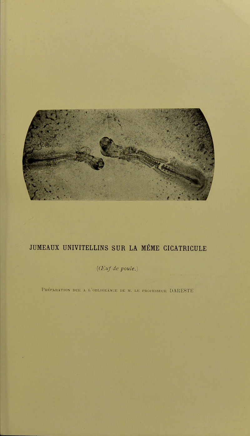 JUMEAUX UNIVITELLINS SUR LA MÊME CICATRIGULE [Œuf de poule.) Préparation due a LonLiCEANOii de m. le proi-esseur DARESTE