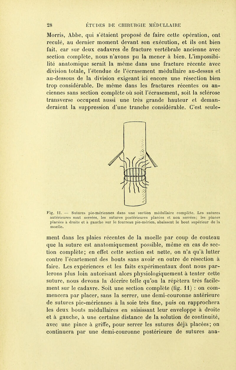 Morris, Abbe, qui s'étaient proposé de faire cette opération, ont reculé, au dernier moment devant son exécution, et ils ont bien fait, car sur deux cadavres de fracture vertébrale ancienne avec section complète, nous n'avons pu la mener à bien. L'impossibi- lité anatomique serait la même dans une fracture récente avec division totale, l'étendue de l'écrasement médullaire au-dessus et au-dessous de la division exigeant ici encore une résection bien trop considérable. De même dans les fractures récentes ou an- ciennes sans section complète où soit l'écrasement, soit la sclérose transverse occupent aussi une très grande hauteur et deman- deraient la suppression d'une tranche considérable. C'est seule- Fig. 11. — Sutures pie-mériennes dans une section médullaire complète. Les sutures antérieures sont serrées, les sutures postérieures placées et non serrées; les pinces placées à droite et à gauche sur le fourreau pie-mérien, abaissent le bout supérieur de la moelle. ment dans les plaies récentes de la moelle par coup de couteau que la suture est anatomiquement possible, même en cas de sec- tion complète; en effet cette section est nette, on n'a qu'à lutter contre l'écartement des bouts sans avoir en outre de résection à faire. Les expériences et les faits expérimentaux dont nous par- lerons plus loin autorisant alors physiologiquement à tenter cette suture, nous devons la décrire telle qu'on la répétera très facile- ment sur le cadavre. Soit une section complète (fig. H) : on com- mencera par placer, sans la serrer, une demi-couronne antérieure de sutures pie-mériennes à la soie très fine, puis on rapprochera les deux bouts médullaires en saisissant leur enveloppe à droite et à gauche, à une certaine distance de la solution de continuité, avec une pince à griffe, pour serrer les sutures déjà placées; on continuera par une demi-couronne postérieure de sutures ana-