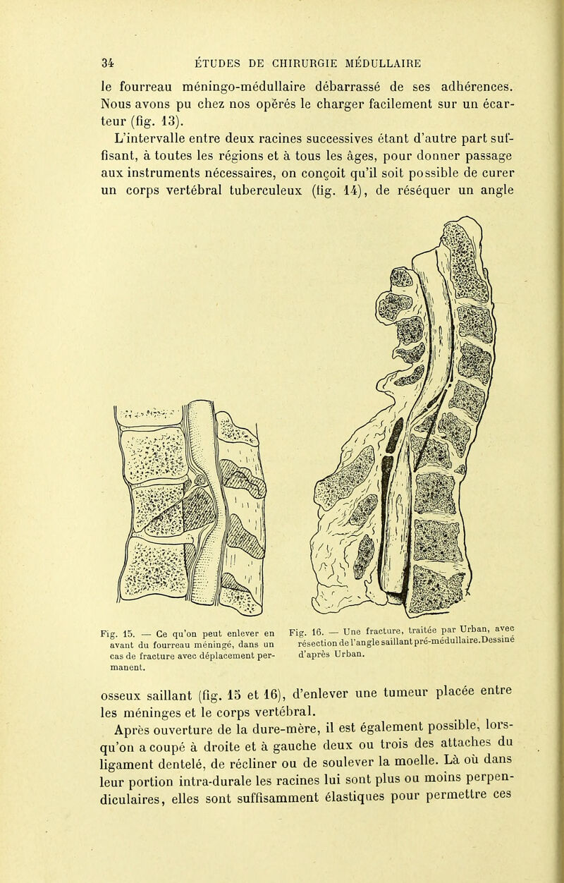 le fourreau méningo-méduUaire débarrassé de ses adhérences. Nous avons pu chez nos opérés le charger facilement sur un écar- teur (flg. 13). L'intervalle entre deux racines successives étant d'autre part suf- fisant, à toutes les régions et à tous les âges, pour donner passage aux instruments nécessaires, on conçoit qu'il soit possible de curer un corps vertébral tuberculeux (tig. 14), de réséquer un angle cas de fracture avec déplacement per- d'après Urban. maneat. osseux saillant (fig. 15 et 16), d'enlever une tumeur placée entre les méninges et le corps vertébral. Après ouverture de la dure-mère, il est également possible, lors- qu'on a coupé à droite et à gauche deux ou trois des attaches du ligament dentelé, de récliner ou de soulever la moelle. Là où dans leur portion intra-durale les racines lui sont plus ou moins perpen- diculaires, elles sont suffisamment élastiques pour permettre ces
