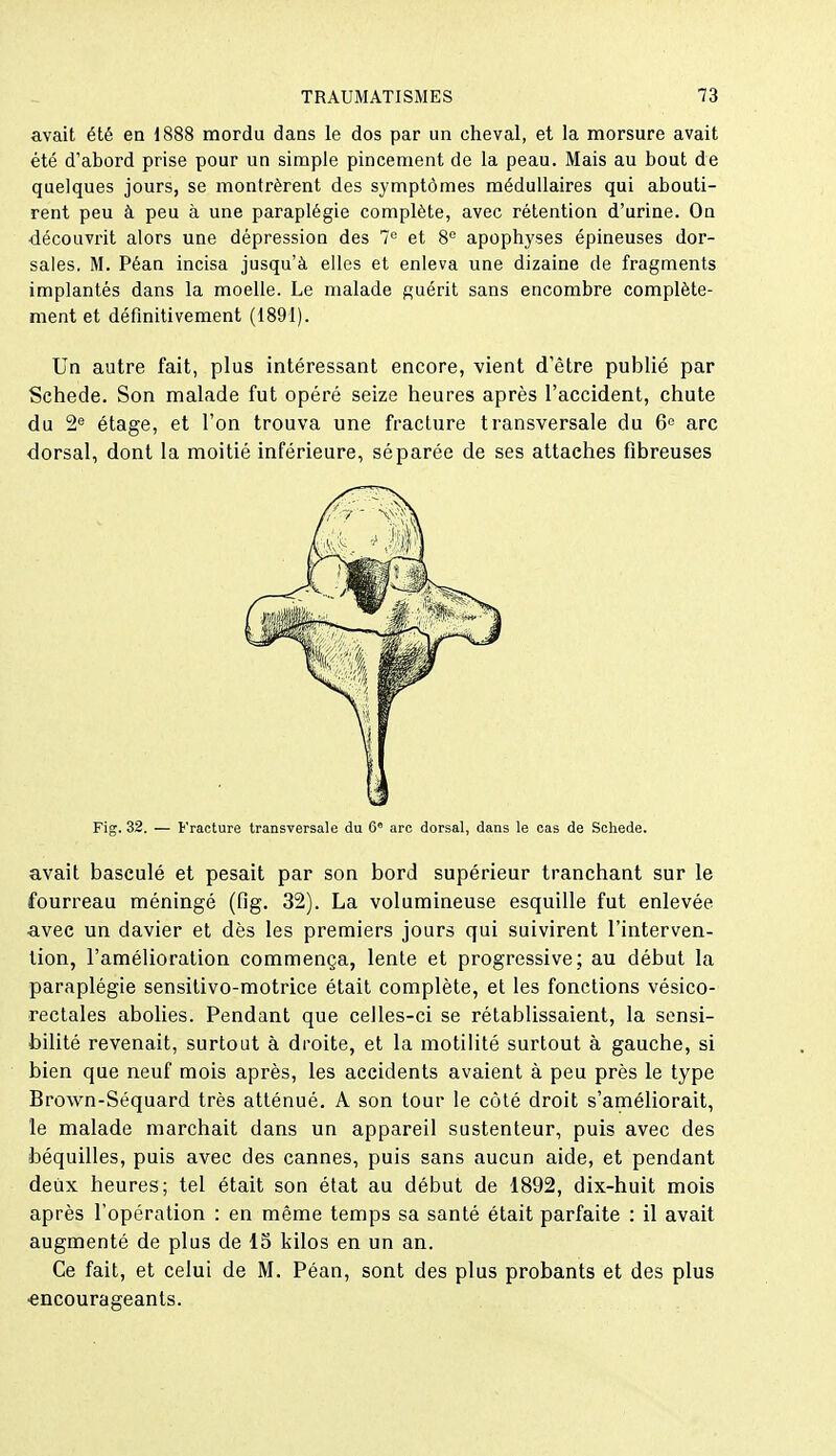 avait été en 1888 mordu daas le dos par un cheval, et la morsure avait été d'abord prise pour un simple pincement de la peau. Mais au bout de quelques jours, se montrèrent des symptômes médullaires qui abouti- rent peu à peu à une paraplégie complète, avec rétention d'urine. On découvrit alors une dépression des 7<= et 8^ apophyses épineuses dor- sales. M. Péan incisa jusqu'à elles et enleva une dizaine de fragments implantés dans la moelle. Le malade guérit sans encombre complète- ment et définitivement (1891). Un autre fait, plus intéressant encore, vient d'être publié par Schede. Son malade fut opéré seize heures après l'accident, chute du 2'^ étage, et l'on trouva une fracture transversale du 6° arc dorsal, dont la moitié inférieure, séparée de ses attaches fibreuses Fig. 32. — Fracture transversale du 6 arc dorsal, dans le cas de Schede. avait basculé et pesait par son bord supérieur tranchant sur le fourreau méningé (fig. 32). La volumineuse esquille fut enlevée avec un davier et dès les premiers jours qui suivirent l'interven- tion, l'amélioration commença, lente et progressive; au début la paraplégie sensitivo-motrice était complète, et les fonctions vésico- rectales abolies. Pendant que celles-ci se rétablissaient, la sensi- bilité revenait, surtout à droite, et la motilité surtout à gauche, si bien que neuf mois après, les accidents avaient à peu près le type Brown-Séquard très atténué. A son tour le côté droit s'améliorait, le malade marchait dans un appareil sustenteur, puis avec des béquilles, puis avec des cannes, puis sans aucun aide, et pendant deux heures; tel était son état au début de 1892, dix-huit mois après l'opération : en même temps sa santé était parfaite : il avait augmenté de plus de 15 kilos en un an. Ce fait, et celui de M. Péan, sont des plus probants et des plus ■encourageants.