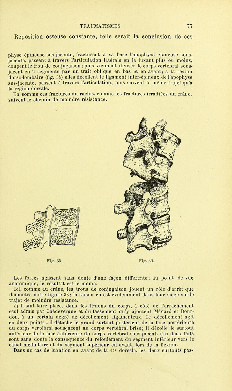 Reposition osseuse constante, telle serait la conclusion de ces physe épineuse sus-jacente, fracturent à sa base l'apophyse épineuse sous- jacenle, passent à travers l'articulation latérale en la luxant plus ou moins, coupent le trou de conjugaison ; puis viennent diviser le corps vertébral sous- jacent en 2 segments par un trait oblique en bas et en avant; à la région dorso-lombaire (fig. 34) elles décollent le ligament inter-épineux de l'apophyse sus-jacente, passent à travers l'articulation, puis suivent le même trajet qu'à la région dorsale. En somme ces fractures du rachis, comme les fractures irradiées du crâne, suivent le chemin de moindre résistance. Les forces agissent sans doute d'une façon différente; au point de vue anatomique, le résultat est le même. Ici, comme au crâne, les trous de conjugaison jouent un rôle d'arrêt que démontre notre figure 33; la raison en est évidemment dans leur siège sur le trajet de moindre résistance. b) Il faut faire place, dans les lésions du corps, à côté de l'arrachement seul admis par Chédevergne et du tassement qu'y ajoutent Ménard et Bour- don, à un certain degré de décollement ligamenteux. Ce décollement agit en deux points : il détache le grand surtout postérieur de la face postérieure du corps vertébral sous-jacent au corps vertébral brisé; il décolle le surtout antérieur de la face antérieure du corps vertébral sous-jacent. Ces deux faits sont sans doute la conséquence du refoulement du segment inférieur vers le canal médullaire et du segment supérieur en avant, lors de la flexion. Dans un cas de luxation en avant de la 11° dorsale, les deux surtouts pas-