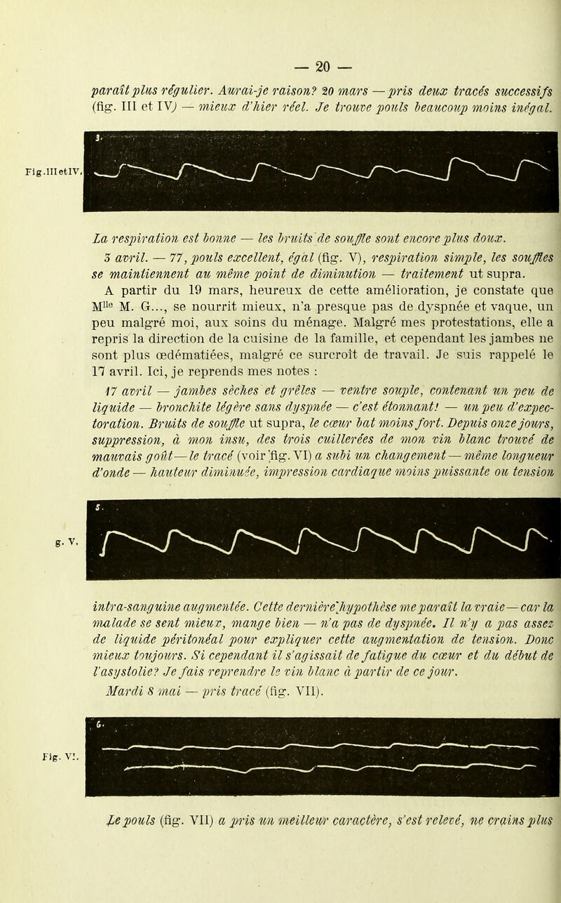 paraît plus régulier. Aurai-je o'aison? 20 mars —pris deux tracés successifs (fig. III et IV; — mieux d'hier réel. Je trouve pouls beaucoup moins inégal. La respiration est boime — les bruits'de soujffle sont encore plus doux. 5 avril. — 77, pouls excelle7it, égal (fig. V), respiration simple, les souffles se maintiennent au même point de diminution — traitement ut supra. A partir du 19 mars, heureux de cette amélioration, je constate que M<^ M. G..., se nourrit mieux, n'a presque pas de dyspnée et vaque, un peu malgré moi, aux soins du ménage. Malgré mes protestations, elle a repris la direction de la cuisine de la famille, et cependant les jambes ne sont plus œdématiées, malgré ce surcroît de travail. Je suis rappelé le 17 avril. Ici, je reprends mes notes : •/7 avril — jambes sèches et grêles — ventre souple, contenant un peu de liquide — bronchite légère sans dTjspnée — c'est étonnant! — i.mpeu d'expec- toration. Bruits de souffle ut supra, le cœur bat moins fort. Depuis onzejotm, suppression, à mon insu, des trois cuillerées de mon vin blanc trouvé de mauvais goût—le tracé (voir]fig. VI) a subi un changement — même longueur d'onde — hauteur diminuée, impression cardiaque moins puissante ou tension intra-sanguine augmentée. Cette dernière''Jiypothèse me paraît lavraic — car la vialade se sent mieux, mange bien — n'a pas de dyspnée. Il n'y a pas assez de liquide péritonéal pour expliquer cette augmentation de tension. Donc mieux toujours. Si cependant il s'agissait de fatigue du cœur et du début de l'asystolie? Je fais reprendre le vin blanc à partir de ce jou/i\ Mardi 8 mai — pris tracé (fig. VII). .^.epouls (fig. Vil) a 2Jris un meillem' caractère, s'est relevé, ne crains plus