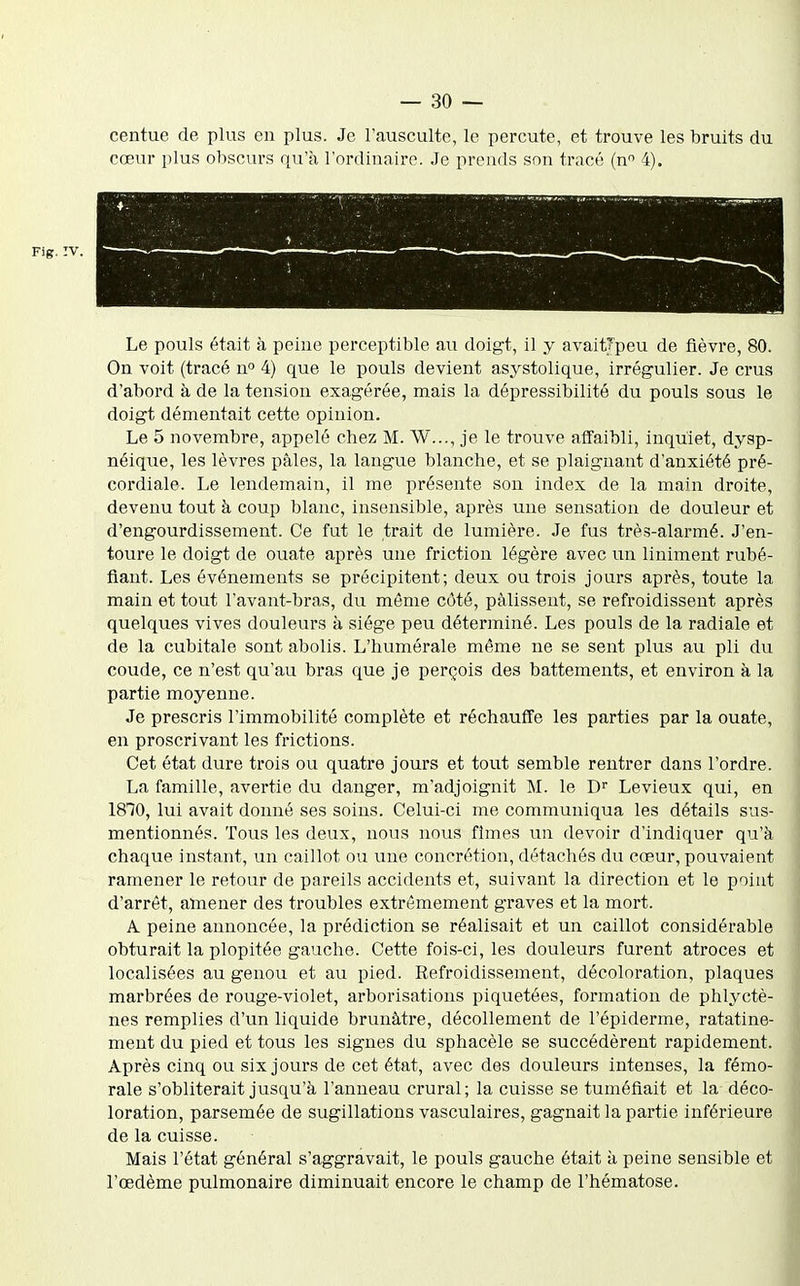 centue de plus en plus. Je l'ausculte, le percute, et trouve les bruits du cœur plus obscurs qu'à l'ordiuairo. Je prends son tracé (n 4). Fig.:v. Le pouls était à peine perceptible au doigt, il y avaitTpeu de fièvre, 80. On voit (tracé n 4) que le pouls devient asystolique, irrégulier. Je crus d'abord à de la tension exagérée, mais la dépressibilité du pouls sous le doigt démentait cette opinion. Le 5 novembre, appelé chez M. W..., je le trouve affaibli, inquiet, dysp- néique, les lèvres pâles, la langue blanche, et se plaignant d'anxiété pré- cordiale. Le lendemain, il me présente son index de la main droite, devenu tout à coup blanc, insensible, après une sensation de douleur et d'engourdissement. Ce fut le trait de lumière. Je fus très-alarmé. J'en- toure le doigt de ouate après une friction légère avec un Uniment rubé- fiant. Les événements se précipitent; deux ou trois jours après, toute la main et tout l'avant-bras, du môme côté, pâlissent, se refroidissent après quelques vives douleurs à siège peu déterminé. Les pouls de la radiale et de la cubitale sont abolis. L'humérale même ne se sent plus au pli du coude, ce n'est qu'au bras que je perçois des battements, et environ à la partie moyenne. Je prescris l'immobilité complète et réchauffe les parties par la ouate, en proscrivant les frictions. Cet état dure trois ou quatre jours et tout semble rentrer dans l'ordre. La famille, avertie du danger, m'adjoignit M. le D Levieux qui, en 1810, lui avait donné ses soins. Celui-ci me communiqua les détails sus- mentionnés. Tous les deux, nous nous fîmes un devoir d'indiquer qu'à chaque instant, un caillot ou une concrétion, détachés du cœur, pouvaient ramener le retour de pareils accidents et, suivant la direction et le point d'arrêt, amener des troubles extrêmement graves et la mort. A peine annoncée, la prédiction se réalisait et un caillot considérable obturait la plopitée gauche. Cette fois-ci, les douleurs furent atroces et localisées au genou et au pied. Refroidissement, décoloration, plaques marbrées de rouge-violet, arborisations piquetées, formation de phlyctè- nes remplies d'un liquide brunâtre, décollement de l'épiderme, ratatine- ment du pied et tous les signes du sphacèle se succédèrent rapidement. Après cinq ou six jours de cet état, avec des douleurs intenses, la fémo- rale s'oblitérait jusqu'à l'anneau crural; la cuisse se tuméfiait et la déco- loration, parsemée de sugillations vasculaires, gagnait la partie inférieure de la cuisse. Mais l'état général s'aggravait, le pouls gauche était à peine sensible et l'œdème pulmonaire diminuait encore le champ de l'hématose.