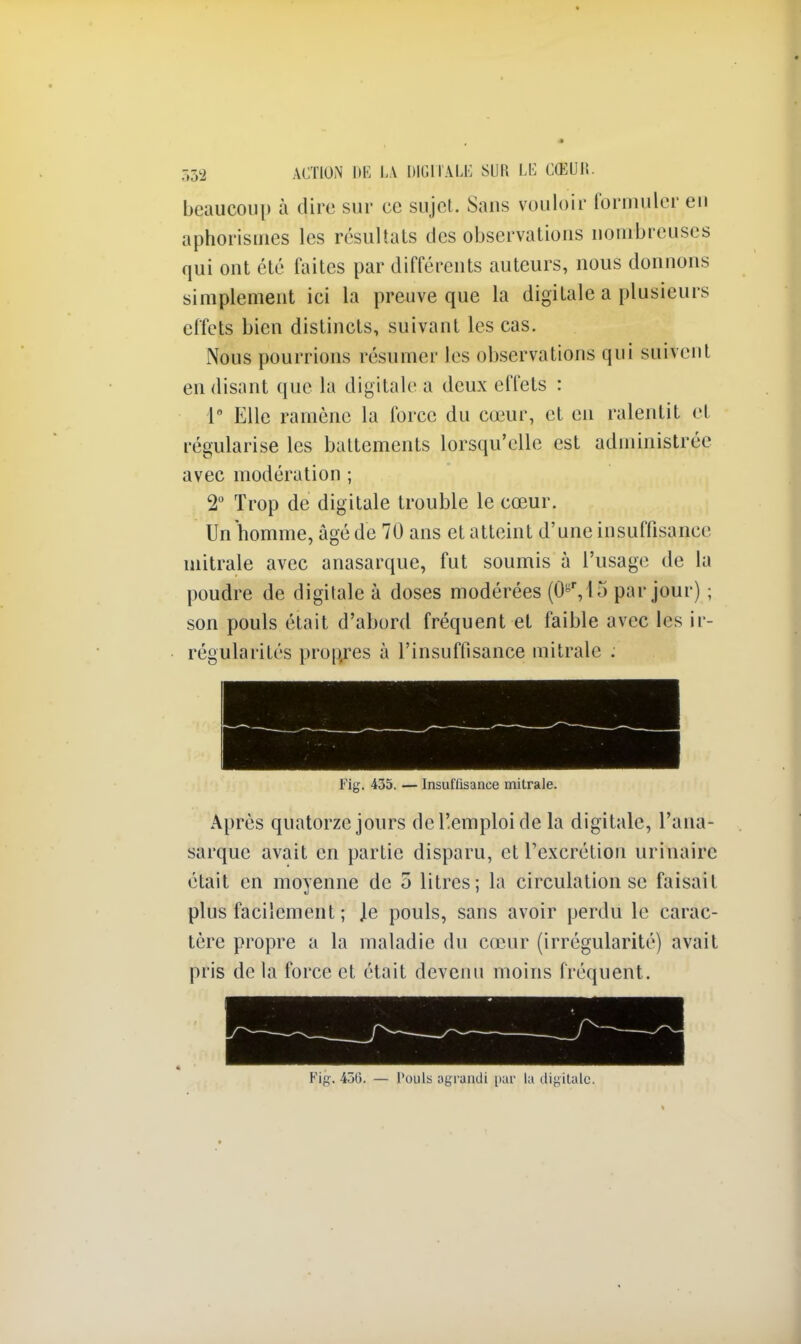 beaucoup à dire sur ce sujet. Sans vouloir formuler en aphorismes les résultats des observations nombreuses qui ont été faites par différents auteurs, nous donnons simplement ici la preuve que la digitale a plusieurs effets bien distincts, suivant les cas. Nous pourrions résumer les observations qui suivent en disant que la digitale a deux effets : 1° Elle ramène la force du cœur, et en ralentit et régularise les battements lorsqu'elle est administrée avec modération ; 2° Trop de digitale trouble le cœur. Un homme, âgé de 70 ans et atteint d'une insuffisance mitrale avec anasarque, fut soumis à l'usage de la poudre de digitale à doses modérées (0gr,15 par jour) ; son pouls était d'abord fréquent et faible avec les ir- régularités propres à l'insuffisance mitrale . Fig. 435. — Insuffisance mitrale. Après quatorze jours del'.emploide la digitale, l'ana- sarque avait en partie disparu, et l'excrétion urinairc était en moyenne de 5 litres; la circulation se faisait plus facilement ; Je pouls, sans avoir perdu le carac- tère propre a la maladie du cœur (irrégularité) avait pris de la force et était devenu moins fréquent. Fig, 430. — Pouls agrandi par la digitale.