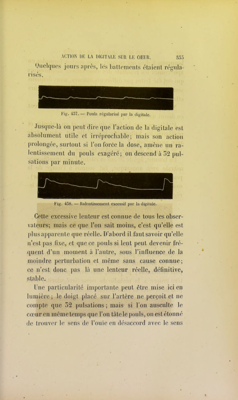 Quelques jours après, les battements étaient régula- risés. Fig. 457. — Pouls régularisé par la digitale. Jusque-là on peut dire que l'action de la digitale est absolument utile et irréprochable; mais son action prolongée, surtout si l'on force la close, amène un ra- lentissement du pouls exagéré; on descend à 52 pul- sations par minute. Fig. 458. — Ralentissement excessif par la digitale. Cette excessive lenteur est connue de tous les obser- vateurs; mais ce que l'on sait moins, c'est qu'elle est plus apparente que réelle. D'abord il faut savoir qu'elle n'est pas fixe, et que ce pouls si lent peut devenir fré- quent d'un moment à l'autre, sous l'influence de la moindre perturbation et même sans cause connue; ce n'est donc pas là une lenteur réelle, définitive, stable. Une particularité importante peut être mise ici en lumière; le doigt placé sur l'artère ne perçoit et ne compte que 52 pulsations ; mais si l'on ausculte le cœur en même temps que l'on tâtele pouls, on est étonné de trouver le sens de l'ouïe en désaccord avec le sens