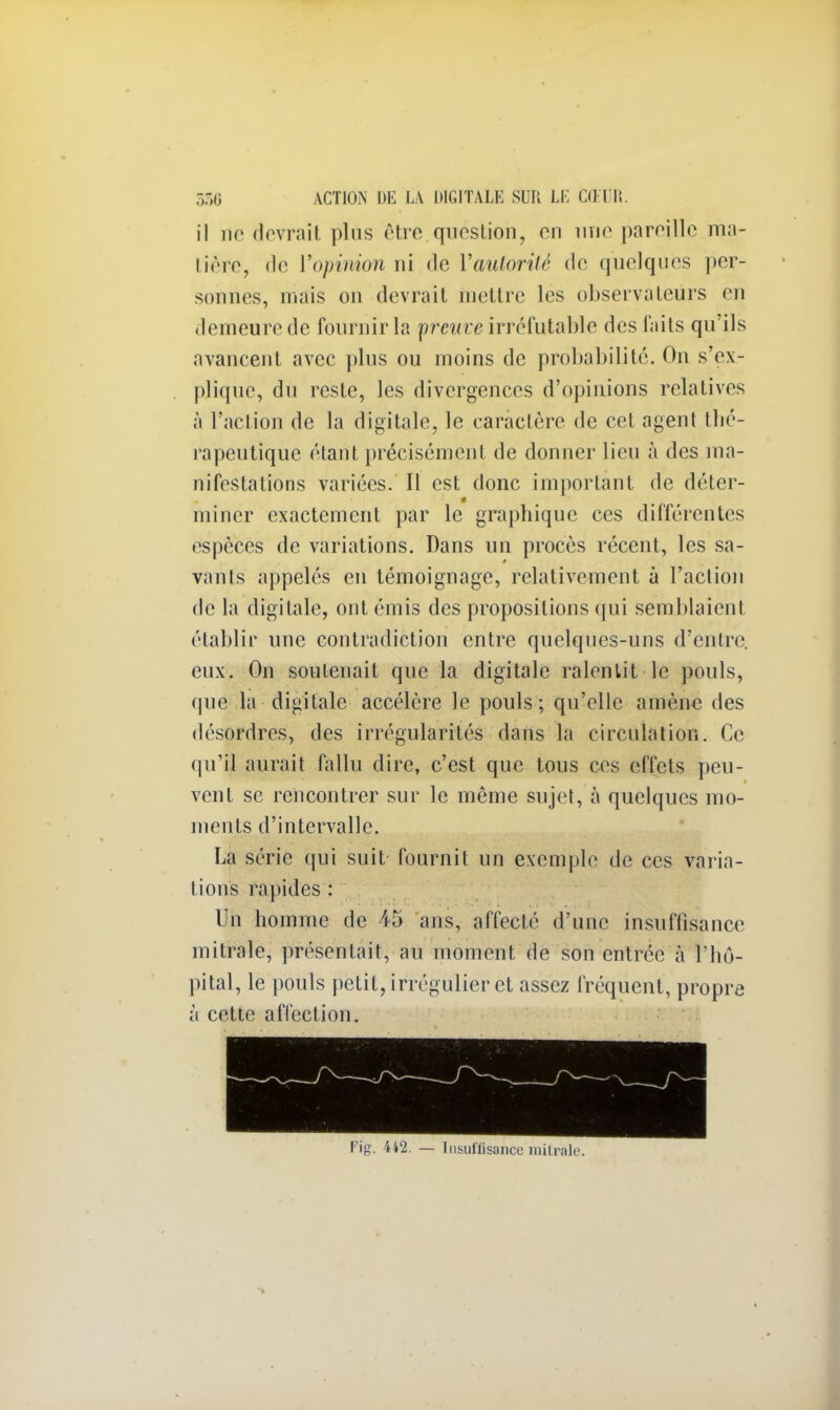 il ne devrait plus être question, en une pareille ma- tière, de l'opinion ni de l'autorité de quelques per- sonnes, mais on devrait mettre les observateurs en demeure de fournir la preuve irréfutable des faits qu'ils avancent avec plus ou moins de probabilité. On s'ex- plique, du reste, les divergences d'opinions relatives à l'action de la digitale, le caractère de cet agent thé- rapeutique étant précisément de donner lieu à des ma- nifestations variées. Il est donc important de déter- miner exactement par le graphique ces différentes espèces de variations. Dans un procès récent, les sa- vants appelés en témoignage, relativement à l'action de la digitale, ont émis des propositions qui semblaient établir une contradiction entre quelques-uns d'entre, eux. On soutenait que la digitale ralentit le pouls, que la digitale accélère le pouls; qu'elle amène des désordres, des irrégularités dans la circulation. Ce qu'il aurait fallu dire, c'est que tous ces effets peu- vent se rencontrer sur le même sujet, à quelques mo- ments d'intervalle. La série qui suit fournit un exemple de ces varia- lions rapides : Un homme de 45 ans, affecté d'une insuffisance mitrale, présentait, au moment de son entrée à l'hô- pital, le pouls petit, irrégulier et assez fréquent, propre à cette affection. Fig. 442. — Insuffisance mitrale.
