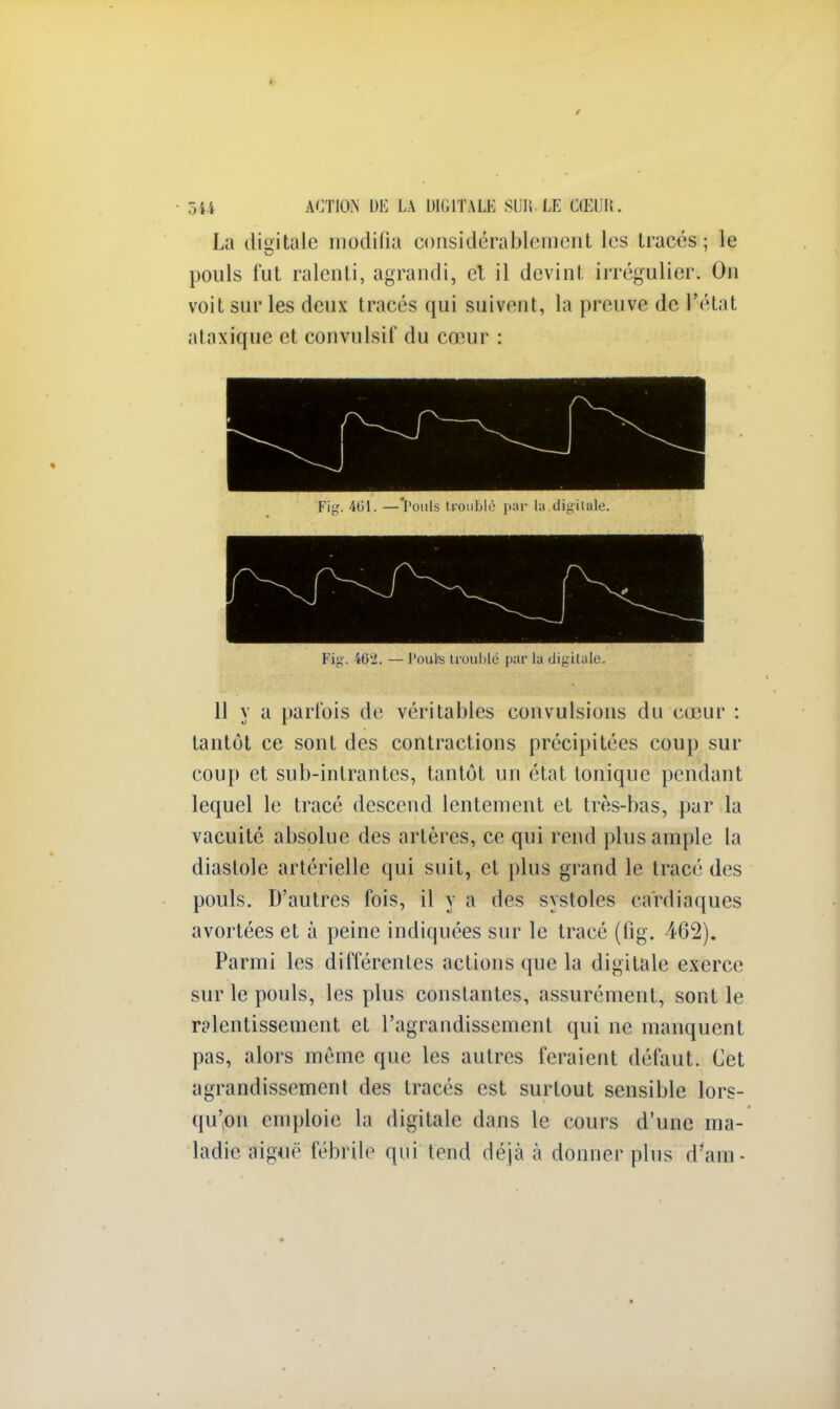 La digitale modifia considérablement les tracés ; le pouls lut ralenti, agrandi, et il devint irrégulier. On voit sur les deux tracés qui suivent, la preuve de l'état ataxique et convulsif du cœur : Fig. 401. —'Pouls troublé pur la digitale. 1 Mg. 46'2. — Pouls troublé par la digitale. 11 y a parfois de véritables convulsions du cœur : tantôt ce sont des contractions précipitées coup sur coup et sub-intrantes, tantôt un état tonique pendant lequel le tracé descend lentement et très-bas, par la vacuité absolue des artères, ce qui rend plus ample la diastole artérielle qui suit, et plus grand le tracé des pouls. D'autres fois, il y a des systoles cardiaques avortées et à peine indiquées sur le tracé (fig. 462). Parmi les différentes actions que la digitale exerce sur le pouls, les plus constantes, assurément, sont le ralentissement et l'agrandissement qui ne manquent pas, alors même que les autres feraient défaut. Cet agrandissement des tracés est surtout sensible lors- qu'on emploie la digitale dans le cours d'une ma- ladie aiguë fébrile qui tend déjà à donner plus d'ani-