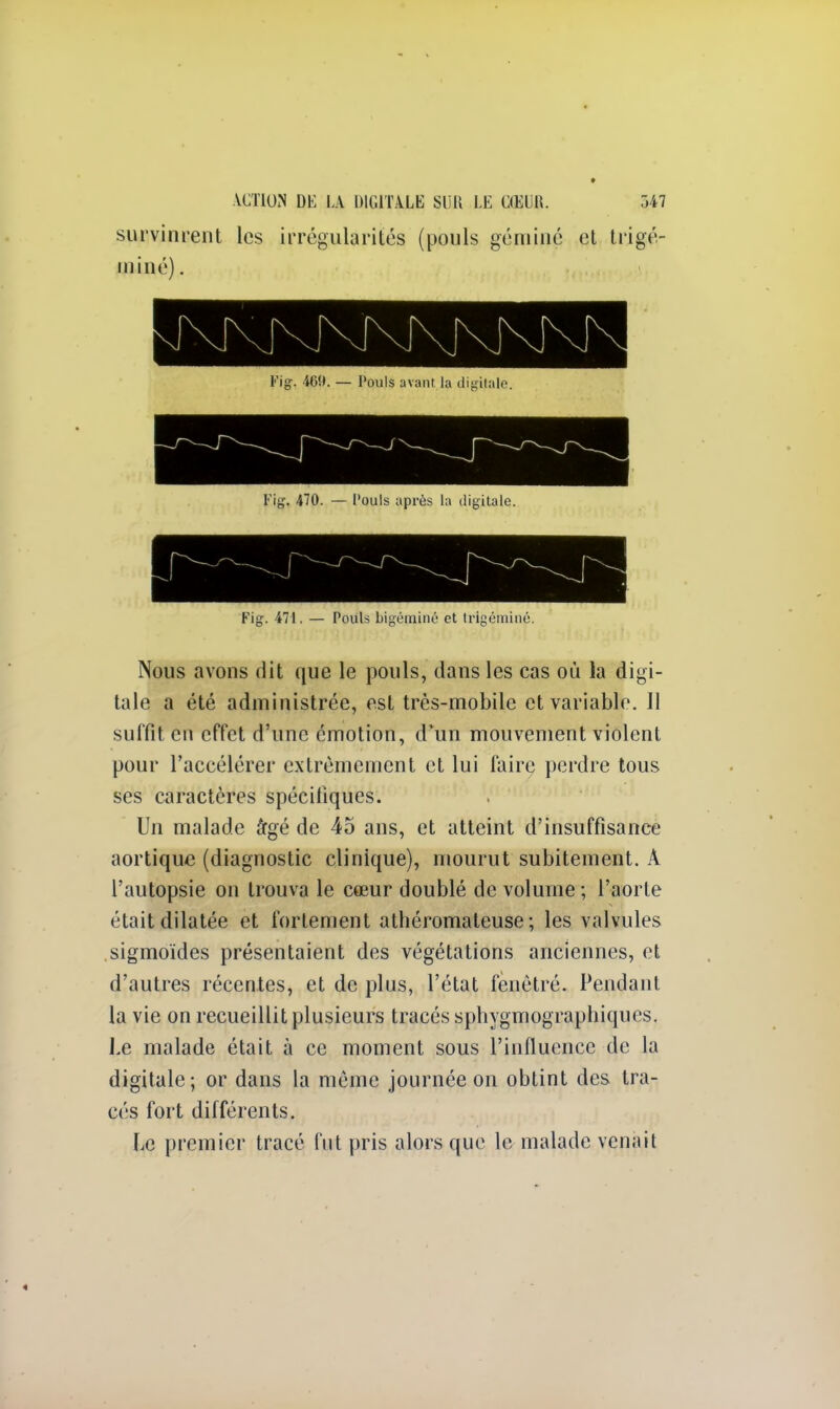 survinrent les irrégularités (pouls géminé et trigé- miné). SE5SSEESSS3 B Fig. 469. — Pouls avant la digitale. Fig. 470. — l'ouls après la digitale. Fig. 471. — Pouls bigéminé et trigéminé. Nous avons dit que le pouls, dans les cas où la digi- tale a été administrée, est très-mobile et variable. Il suffit en effet d'une émotion, d un mouvement violent pour l'accélérer extrêmement et lui faire perdre tous ses caractères spécifiques. Un malade âgé de 45 ans, et atteint d'insuffisance aortique (diagnostic clinique), mourut subitement. À l'autopsie on trouva le cœur doublé de volume ; l'aorte était dilatée et fortement athéromateuse ; les valvules sigmoïdes présentaient des végétations anciennes, et d'autres récentes, et de plus, l'état fenètré. Pendant la vie on recueillit plusieurs tracés sphygmographiques. Le malade était à ce moment sous l'influence de la digitale; or dans la môme journée on obtint des tra- cés fort différents. Le premier tracé fut pris alors que le malade venait