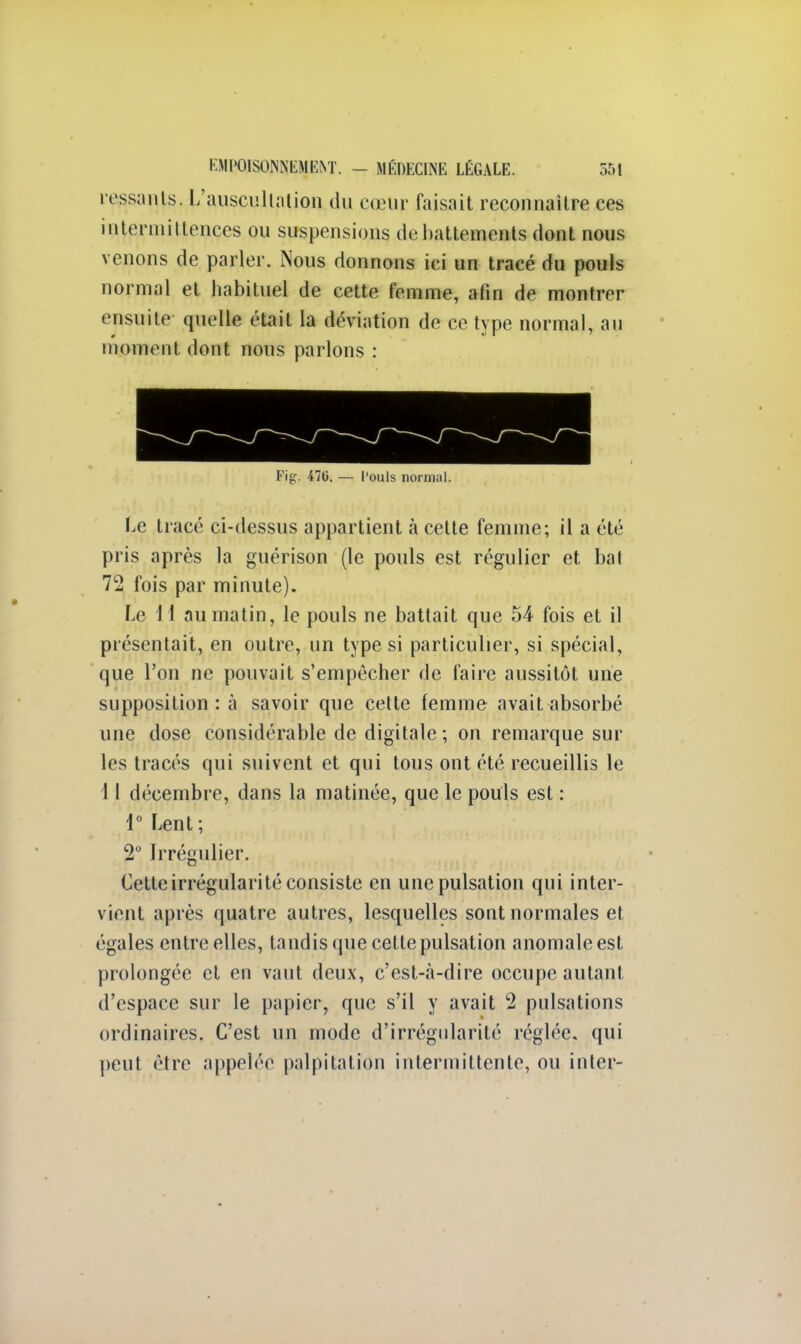 ivssants. L'auscultation du cœur faisait reconnaître ces interiuittences ou suspensions de battements dont nous venons de parler. Nous donnons ici un tracé du pouls normal et habituel de cette femme, afin de montrer ensuite quelle était la déviation de ce type normal, au moment dont nous parlons : Fig. 476. — l'ouls normal. Le tracé ci-dessus appartient à cette femme; il a été pris après la guérison (le pouls est régulier et bal 72 fois par minute). Le 11 au matin, le pouls ne battait que 54 fois et il présentait, en outre, un type si particulier, si spécial, que l'on ne pouvait s'empêcher de faire aussitôt une supposition: à savoir que cette femme avait absorbé une dose considérable de digitale; on remarque sur les tracés qui suivent et qui tous ont été recueillis le 1 I décembre, dans la matinée, que le pouls est : 1° Lent; 2° Irrégulier. Cette irrégularité consiste en une pulsation qui inter- vient après quatre autres, lesquelles sont normales et égales entre elles, tandis que cette pulsation anomale est prolongée et en vaut deux, c'est-à-dire occupe autant d'espace sur le papier, que s'il y avait 2 pulsations ordinaires. C'est un mode d'irrégularité réglée, qui peut être appelée palpitation intermittente, ou inter-