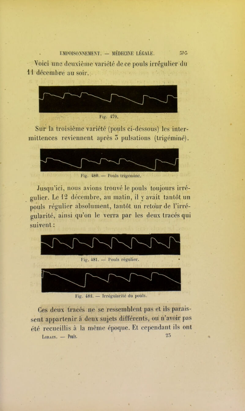 Voici une deuxième variété de ce pouls irrégulier du 11 décembre au soir. Fig. 479. Sur la troisième variété (pouls ci-dessous) les inter- mittences reviennent après 5 pulsations (trigéminé). Fig. 480. — Pouls Irigéininé. Jusqu'ici, nous avions trouvé le pouls toujours irré- eulicr. Le 12 décembre, au matin, il v avait tantôt un pouls régulier absolument, tantôt un retour de l'irré- gularité, ainsi qu'on le verra par les deux tracés qui suivent : Fig. 481. — Pouls régulier. Fig. 48i. — Irrégularité du pouls. Ces deux tracés ne se ressemblent pas et ils parais- sent appartenir à deux sujets différents, ou n'avoir pas été recueillis à la même époqne. Et cependant ils ont Loium. — Pouls.