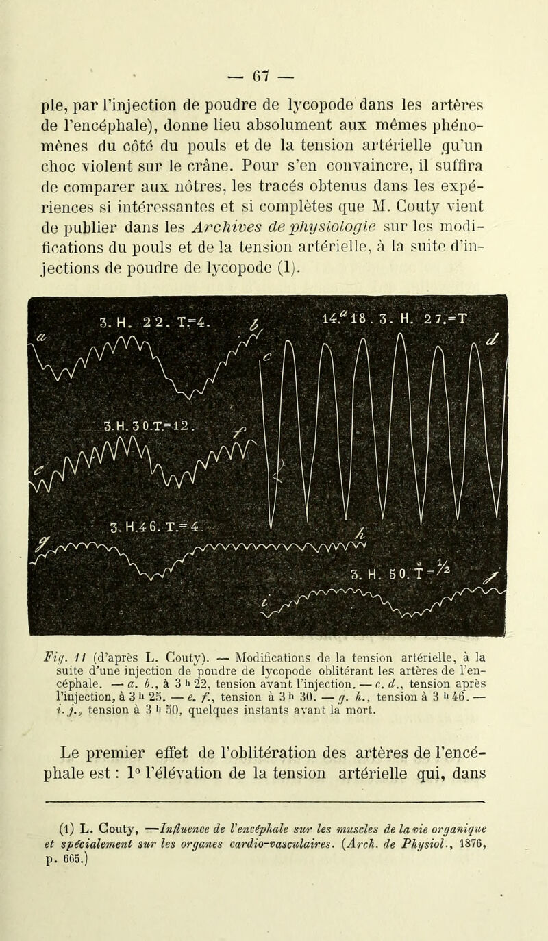 pie, par l’injection de poudre de lycopode dans les artères de l’encéphale), donne lieu absolument aux mêmes phéno- mènes du côté du pouls et de la tension artérielle qu’un choc violent sur le crâne. Pour s’en convaincre, il suffira de comparer aux nôtres, les tracés obtenus dans les expé- riences si intéressantes et si complètes que M. Couty vient de publier dans les Archives de physiologie sur les modi- fications du pouls et de la tension artérielle, à la suite d’in- jections de poudre de lycopode (1). Fig. Il (d’après L. Couty). — Modifications de la tension artérielle, à la suite d’une injection de poudre de lycopode oblitérant les artères de l’en- céphale. — a. b., à 3 ii 22, tension avant l’injection. — c. d., tension après l’injection, à 3 i* 23. — e. f., tension à 3 >> 30. — g. h., tension à 3 *> 46. — i.j., tension à 3 l' 50, quelques instants avant la mort. Le premier effet de l’oblitération des artères de l’encé- phale est : 1° l’élévation de la tension artérielle qui, dans (l) L. Couty, —Influence de l'encéphale sur les muscles de la vie organique et spécialement sur les organes cardio-vasculaires. (Arch. de Physiol., 1876, p. 665.)