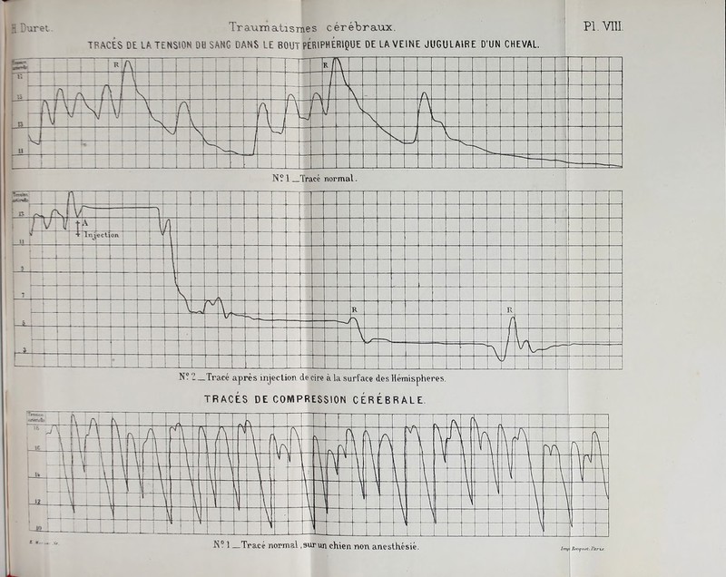 uret Traumatismes cérébraux. TBACÉS DE LA TENSION DU SANG DANS LE BOUT PÉRIPHÉRIQUE DE LA VEINE JUGULAIRE D'UN CHEVAL. PI VIII : ; - ! n> fîô/ |A Injecté o il +4-4 4b A N? 2_Tracé après injection de cire à la surface des Hémisphères. TRACÉS DECOMPRESSION CÉRÉBRALE